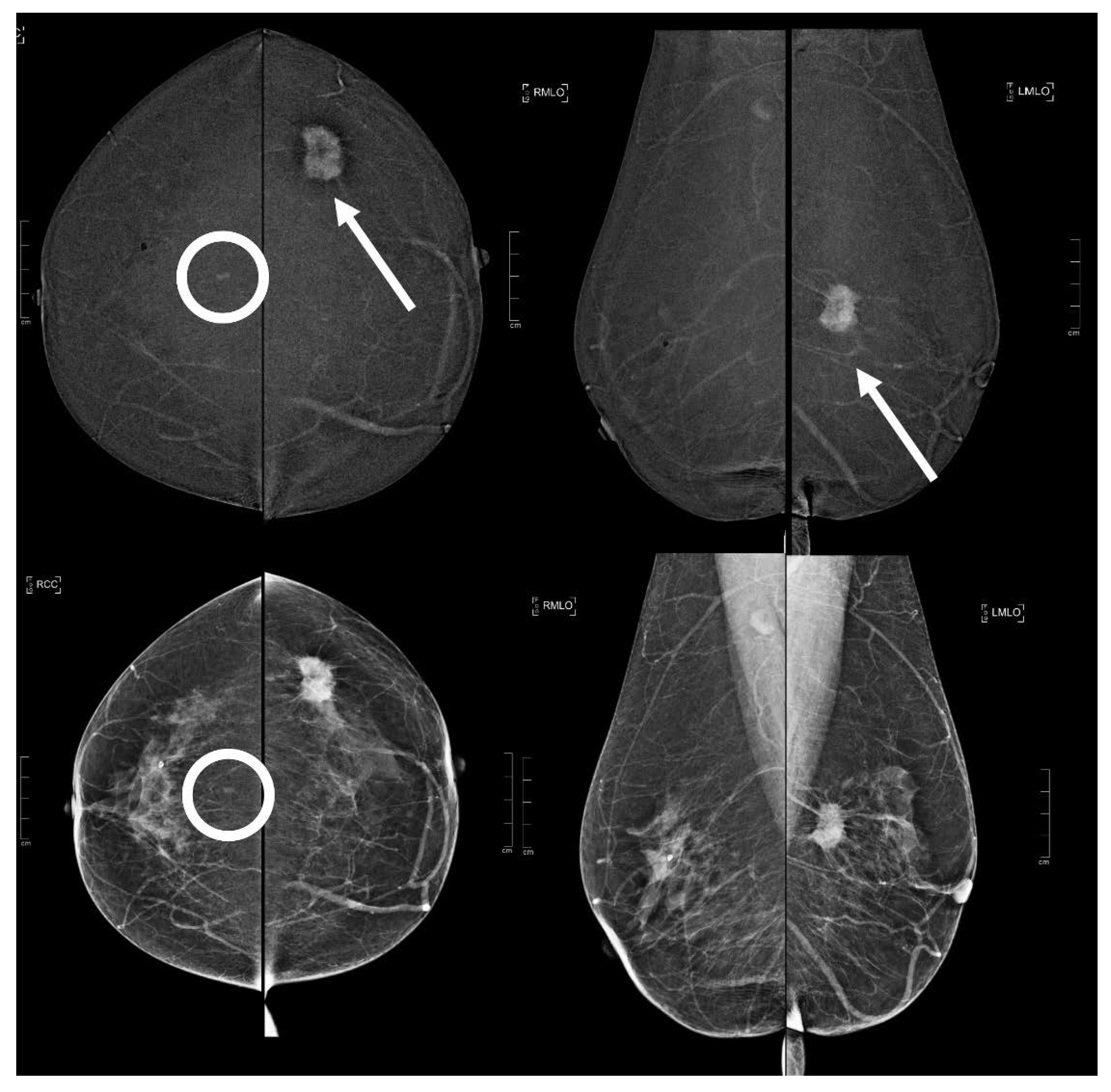 Diagnostics 13 01011 g004 Diagnostics 13 01011 g004