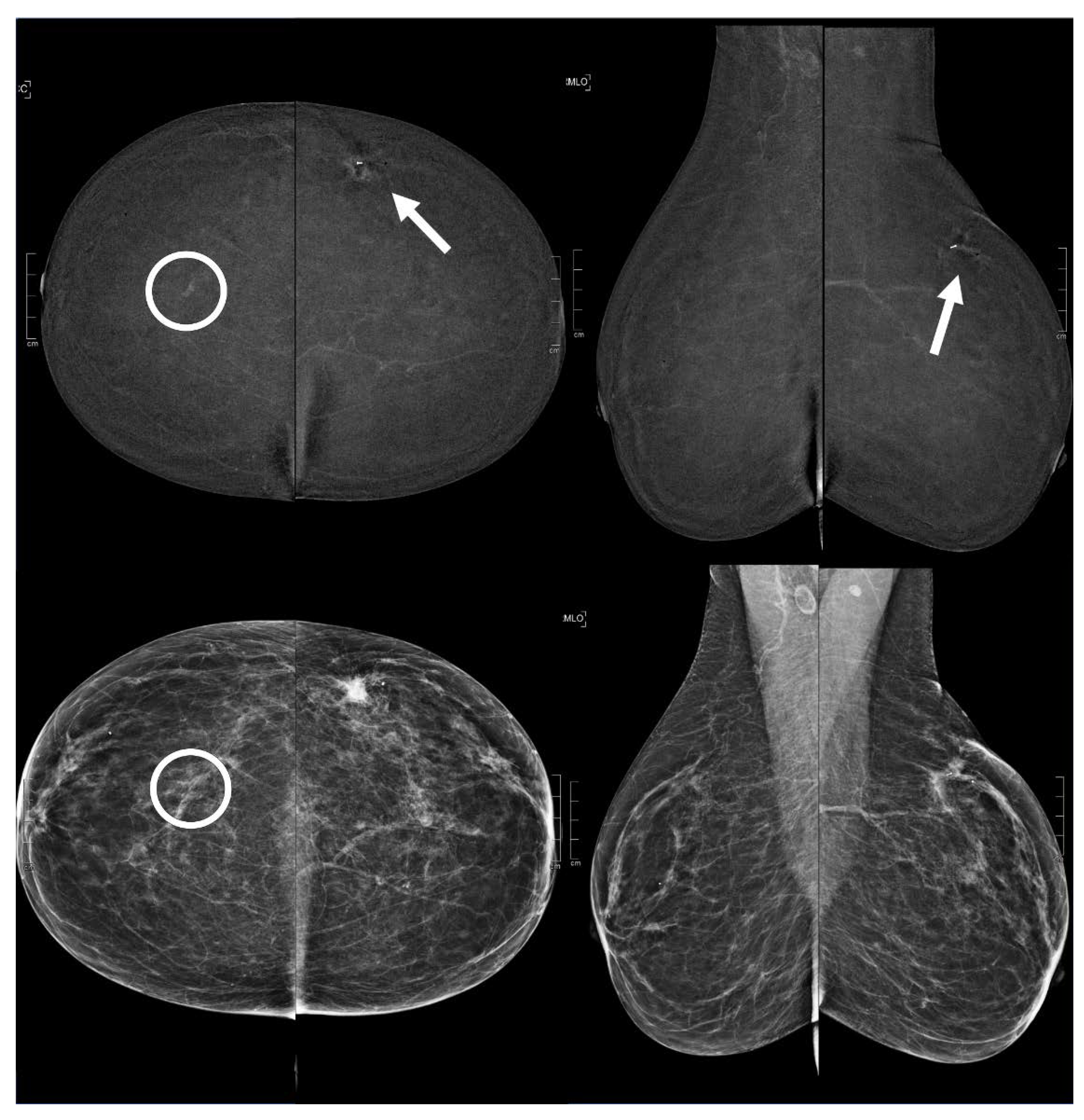 Diagnostics 13 01011 g006 Diagnostics 13 01011 g006