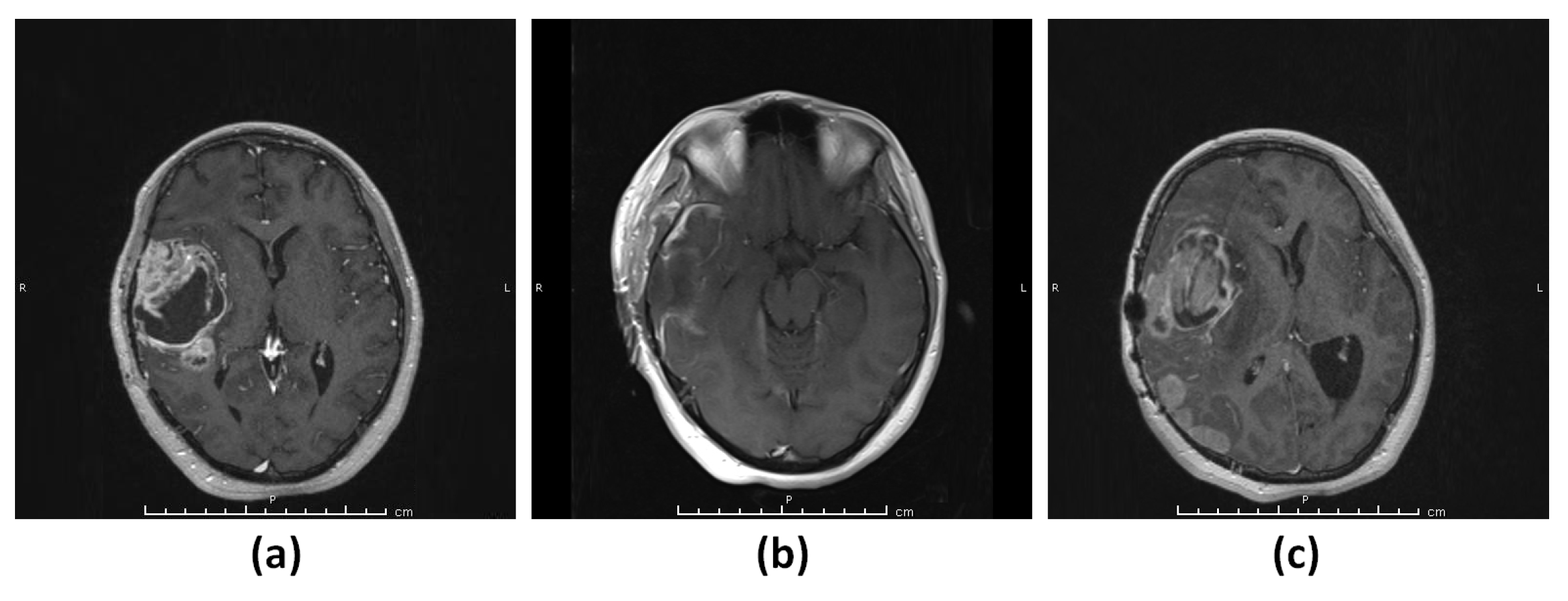 Diagnostics 13 01017 g001
