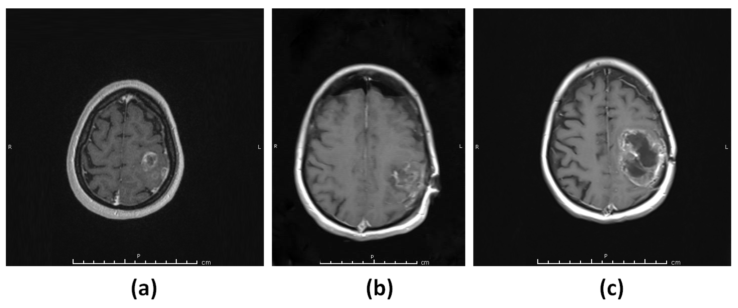 Diagnostics 13 01017 g002