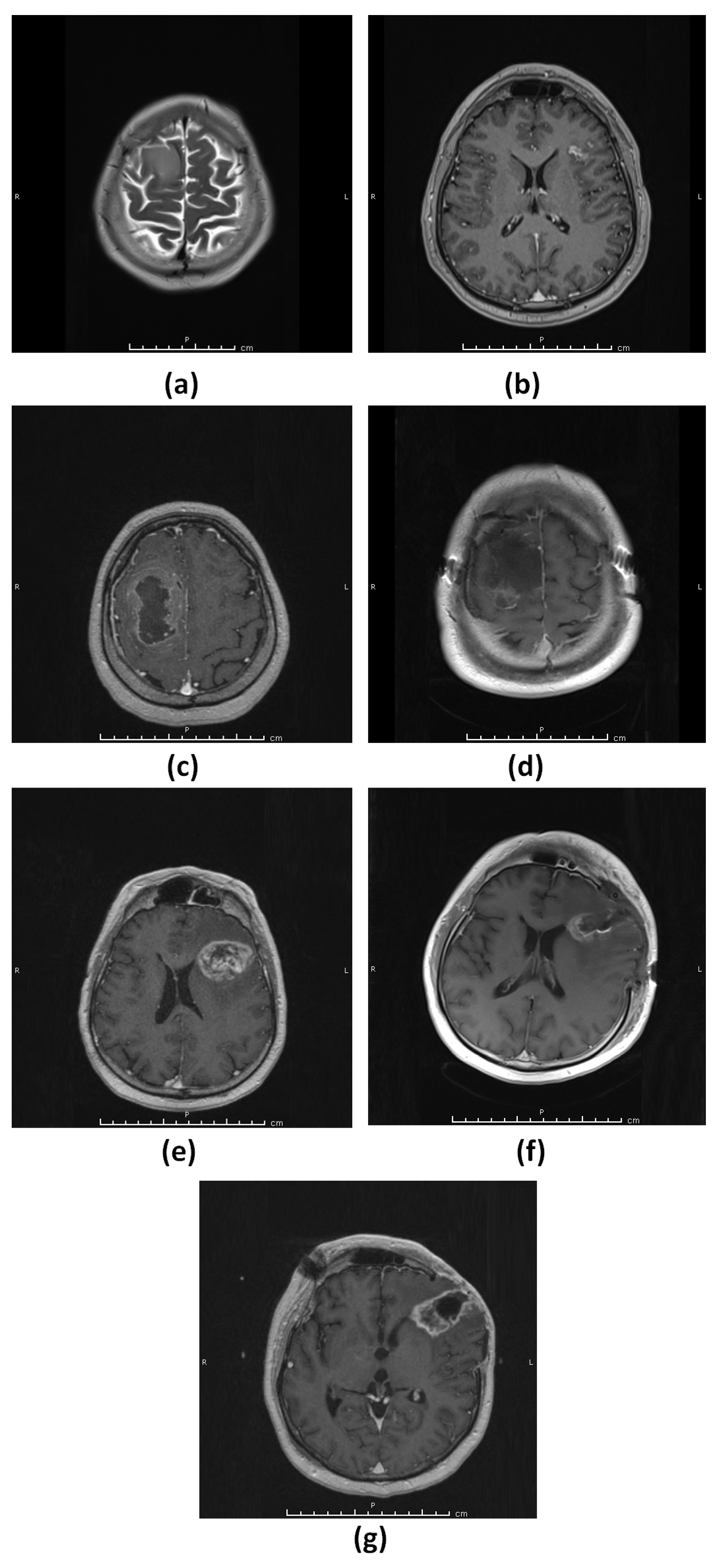 Diagnostics 13 01017 g003