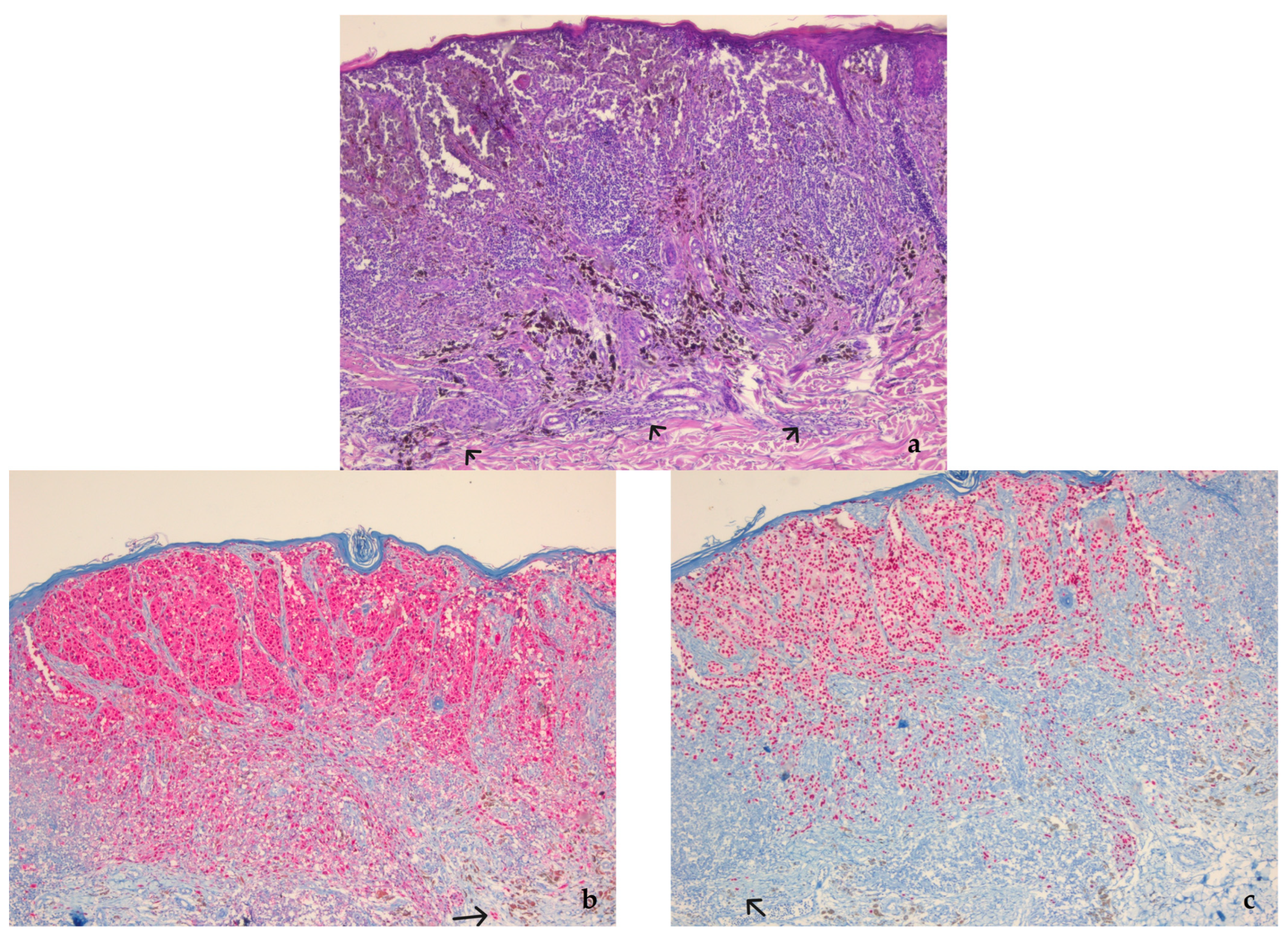 Diagnostics 13 01020 g002a