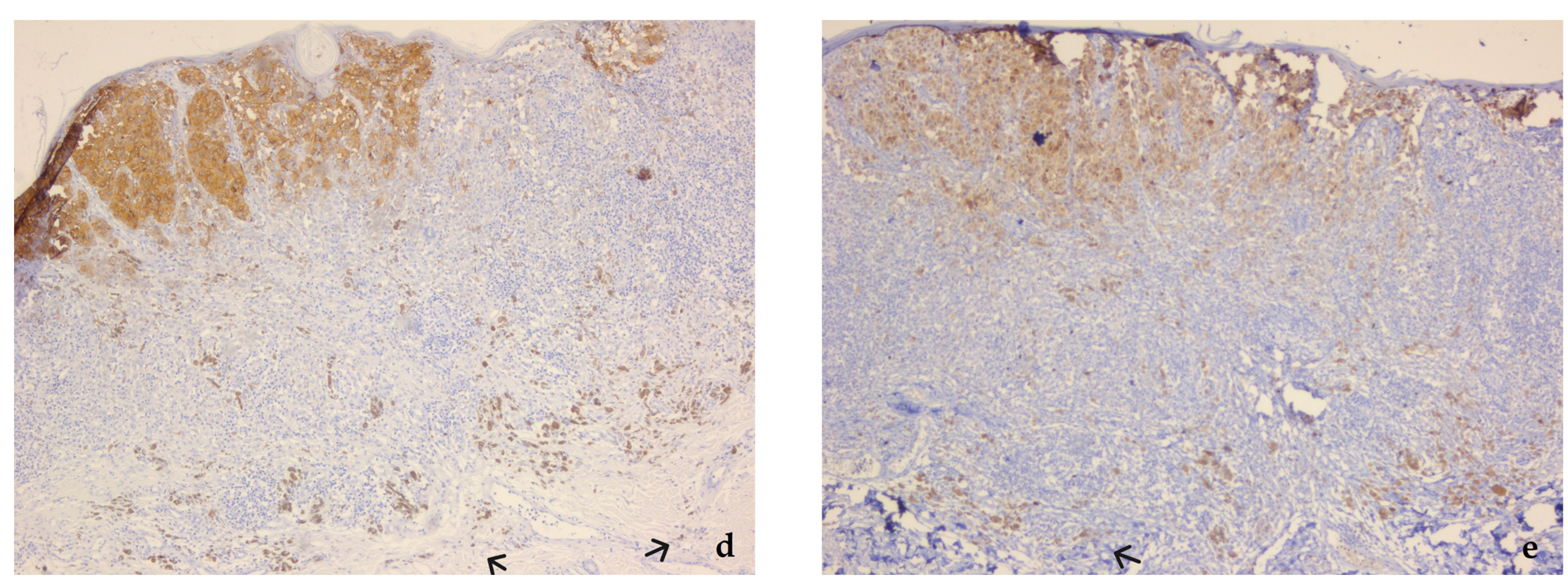 Diagnostics 13 01020 g002b