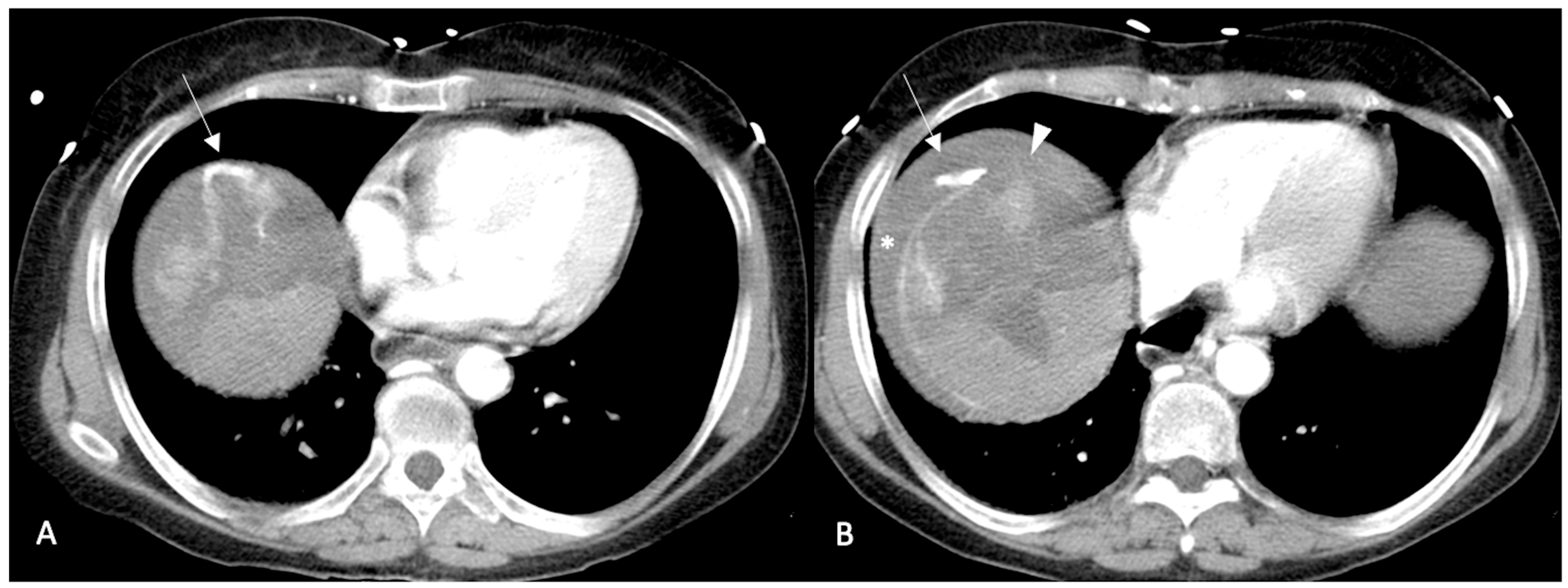 Diagnostics 13 01021 g001 Diagnostics 13 01021 g001