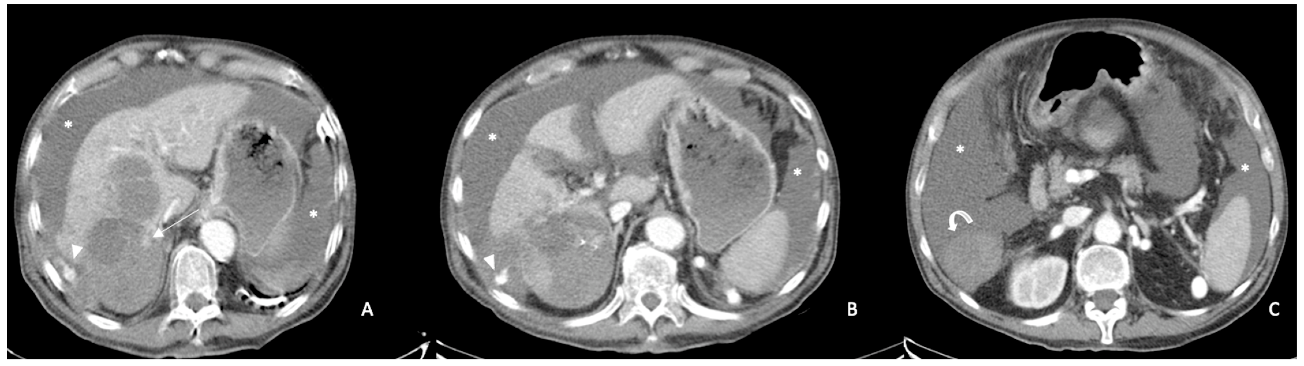 Diagnostics 13 01021 g002 Diagnostics 13 01021 g002