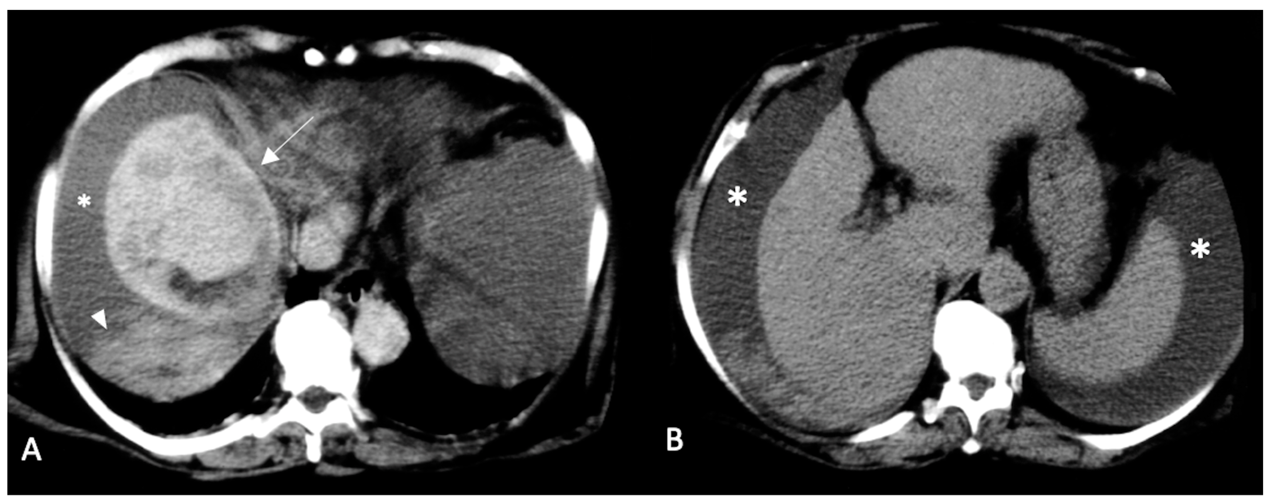 Diagnostics 13 01021 g003 Diagnostics 13 01021 g003