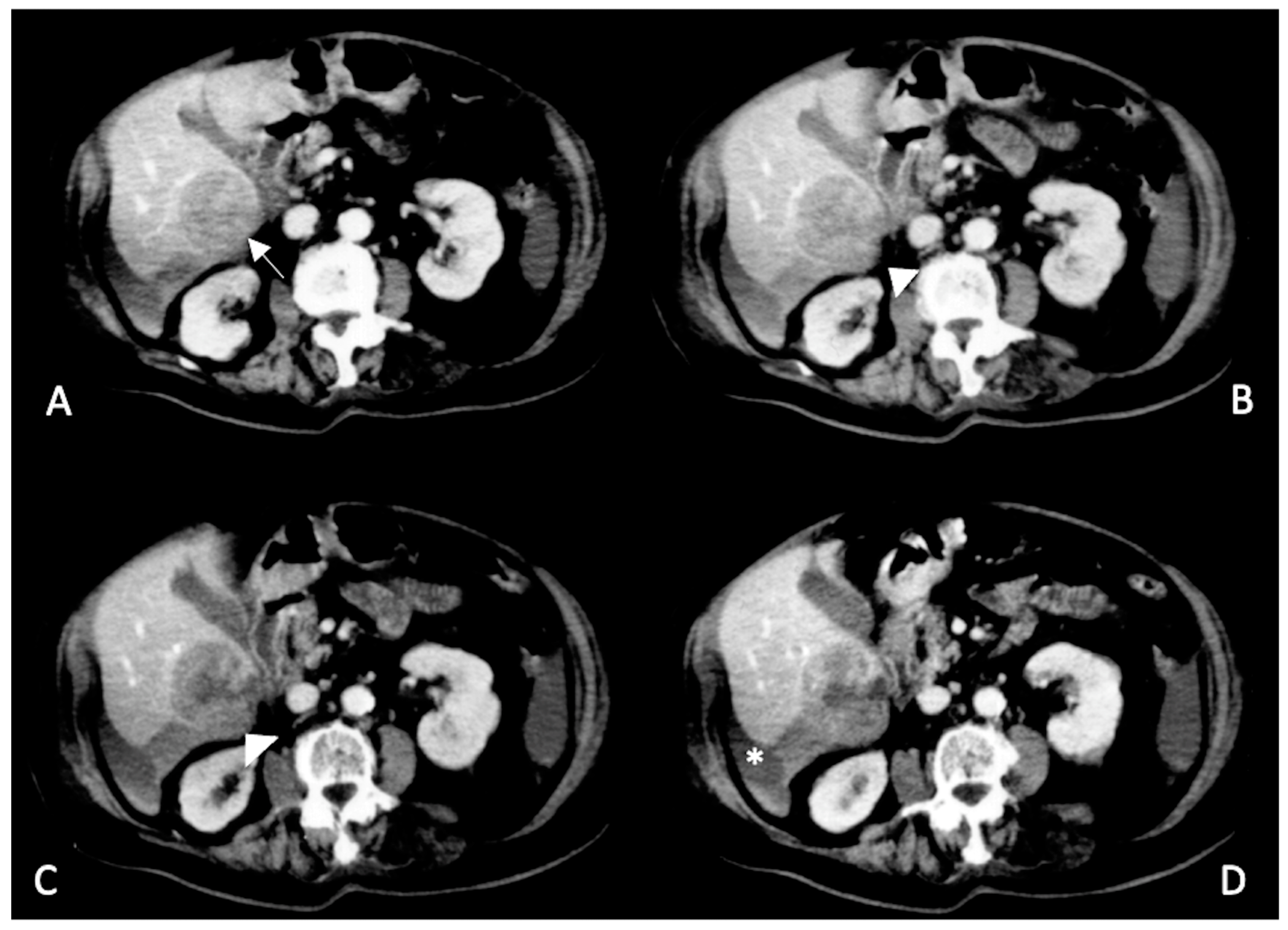 Diagnostics 13 01021 g006 Diagnostics 13 01021 g006