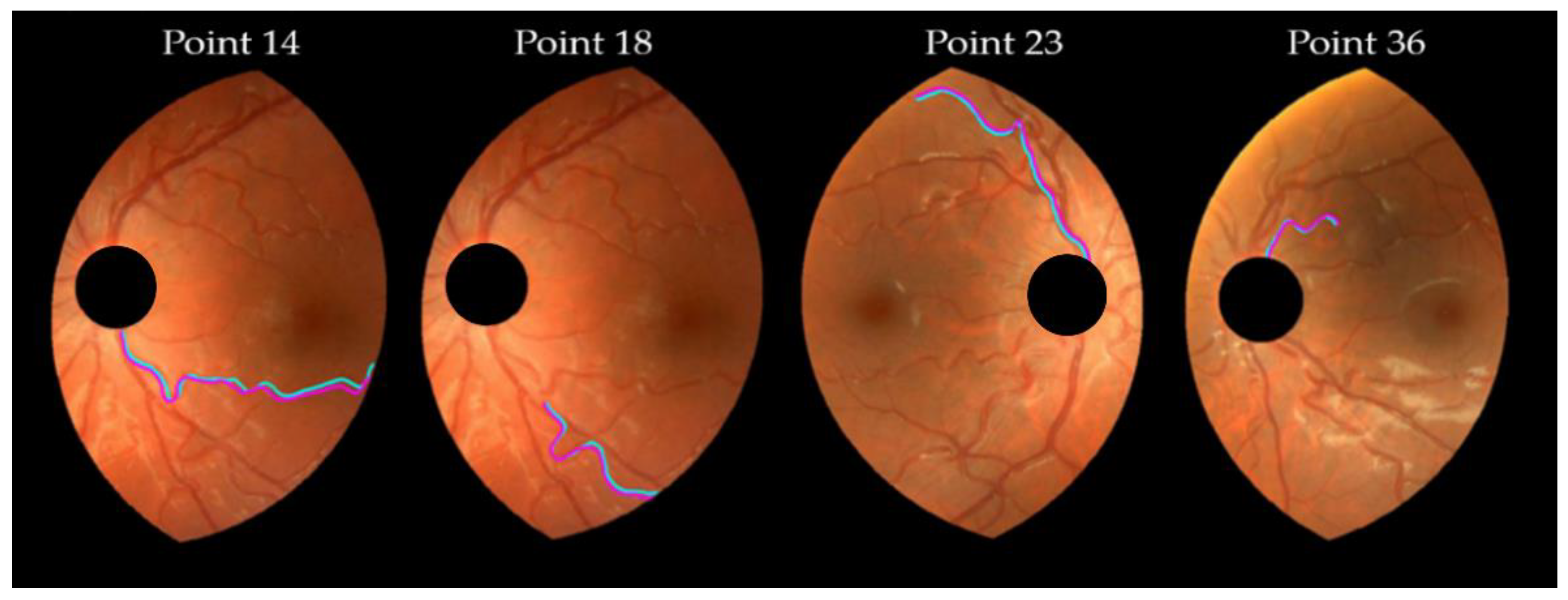 Diagnostics 13 01030 g009 Diagnostics 13 01030 g009