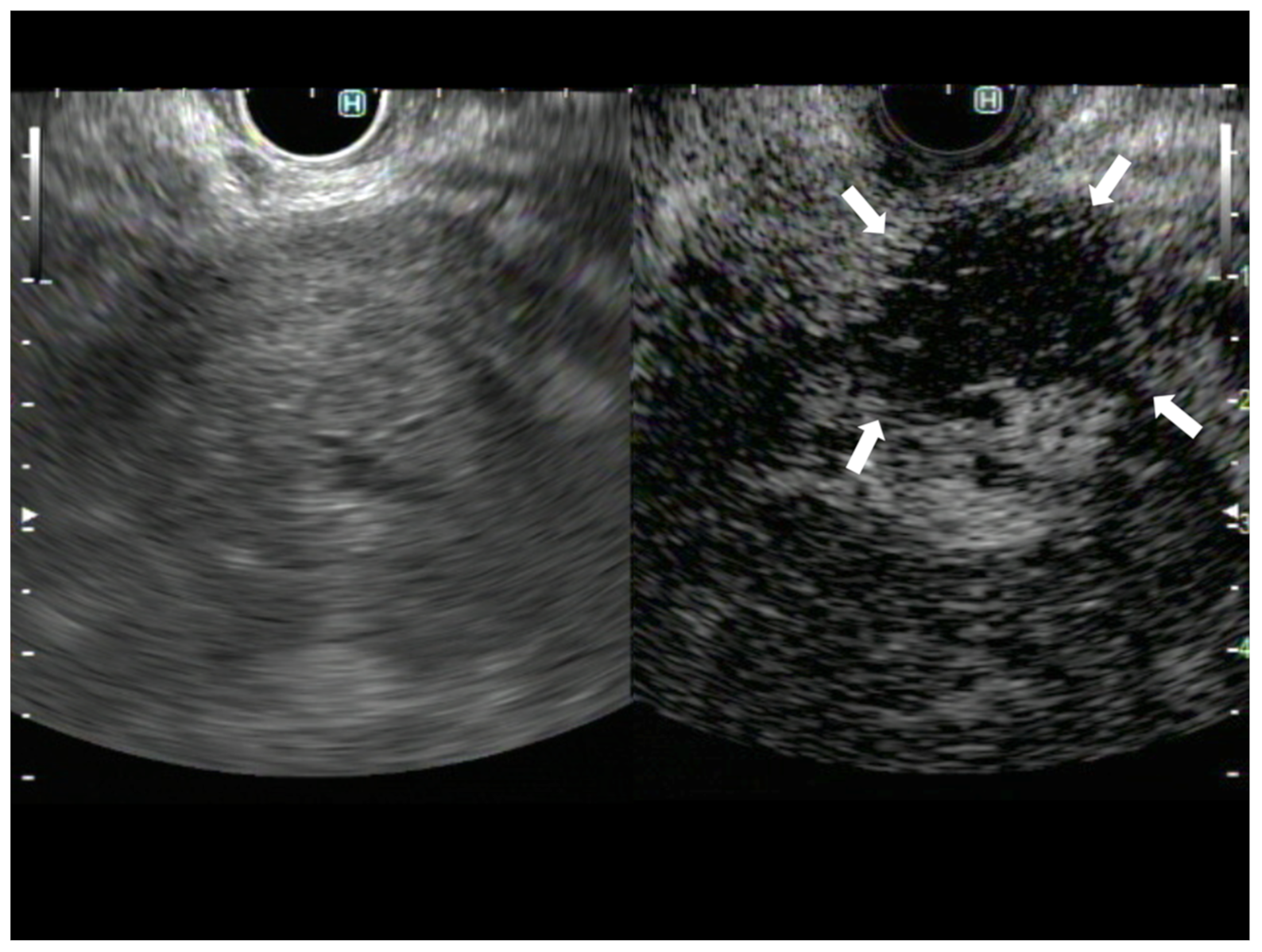 Diagnostics 13 01039 g002 550