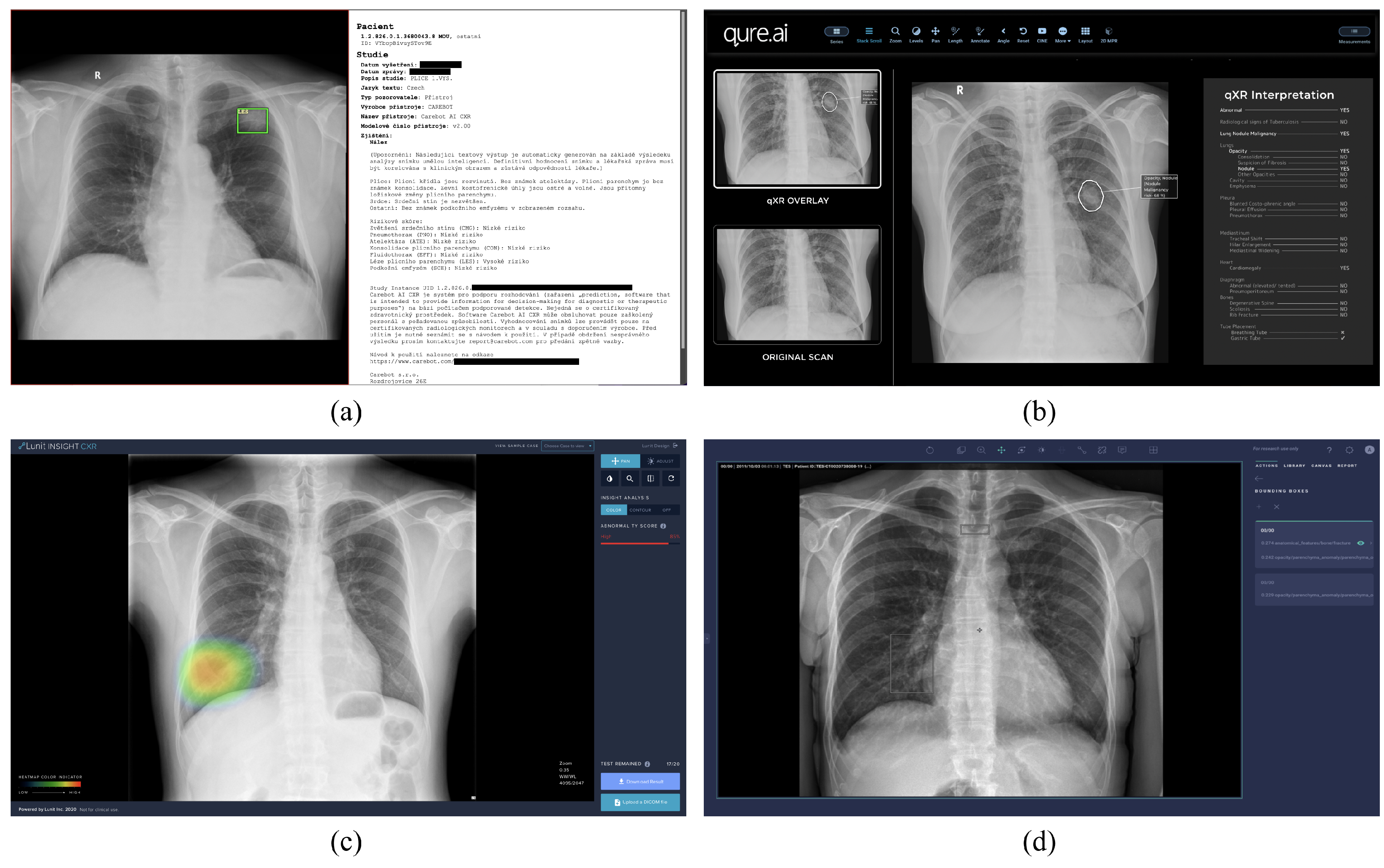 Diagnostics 13 01043 g002 Diagnostics 13 01043 g002