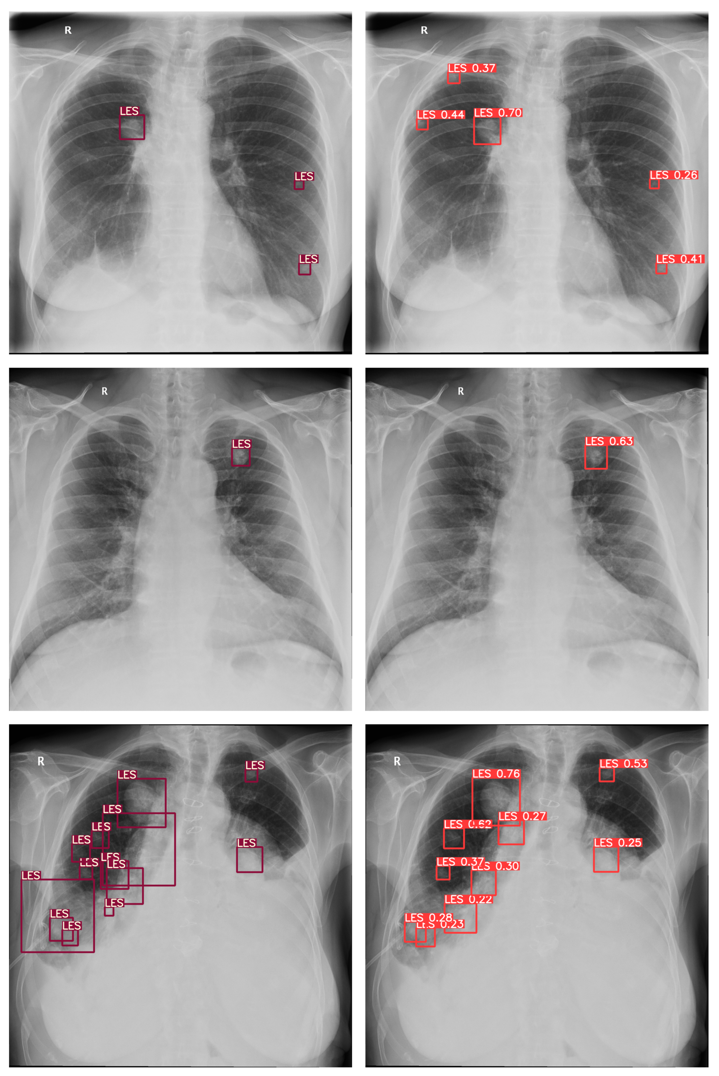 Diagnostics 13 01043 g004 Diagnostics 13 01043 g004