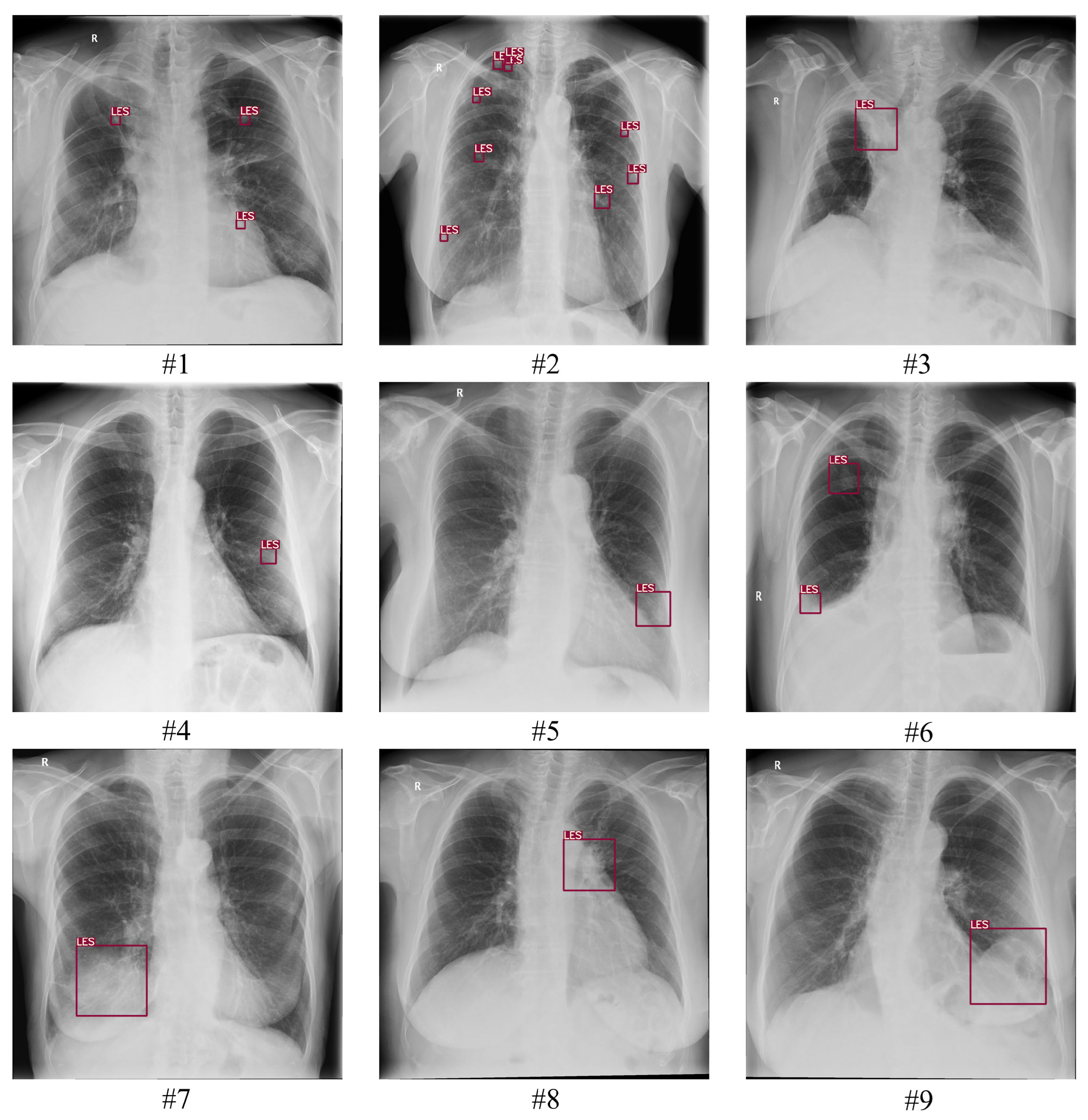 Diagnostics 13 01043 g0a1 Diagnostics 13 01043 g0a1