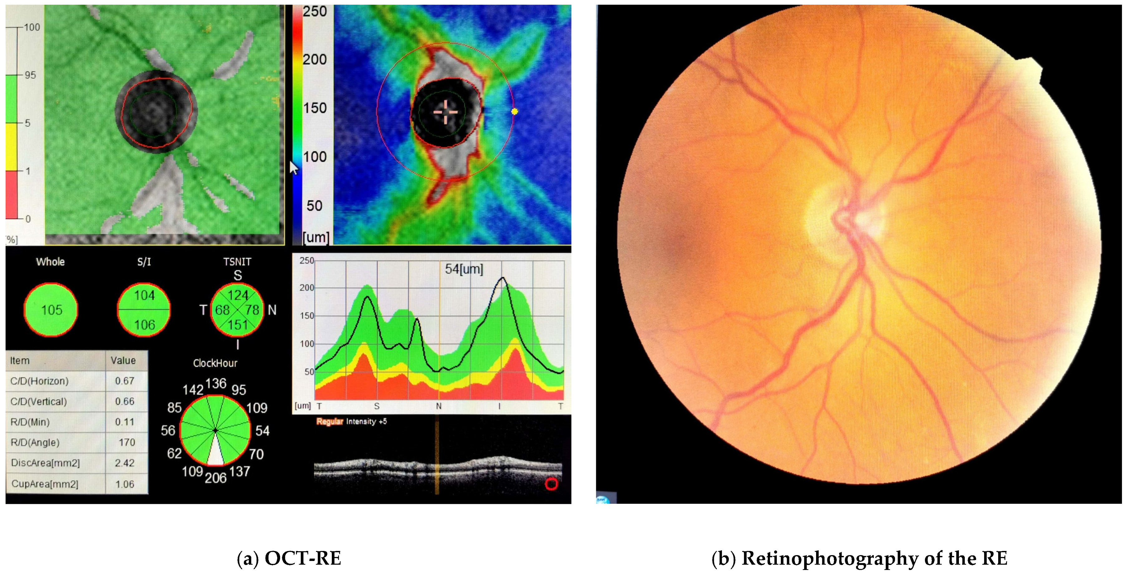 Diagnostics 13 01052 g002 Diagnostics 13 01052 g002