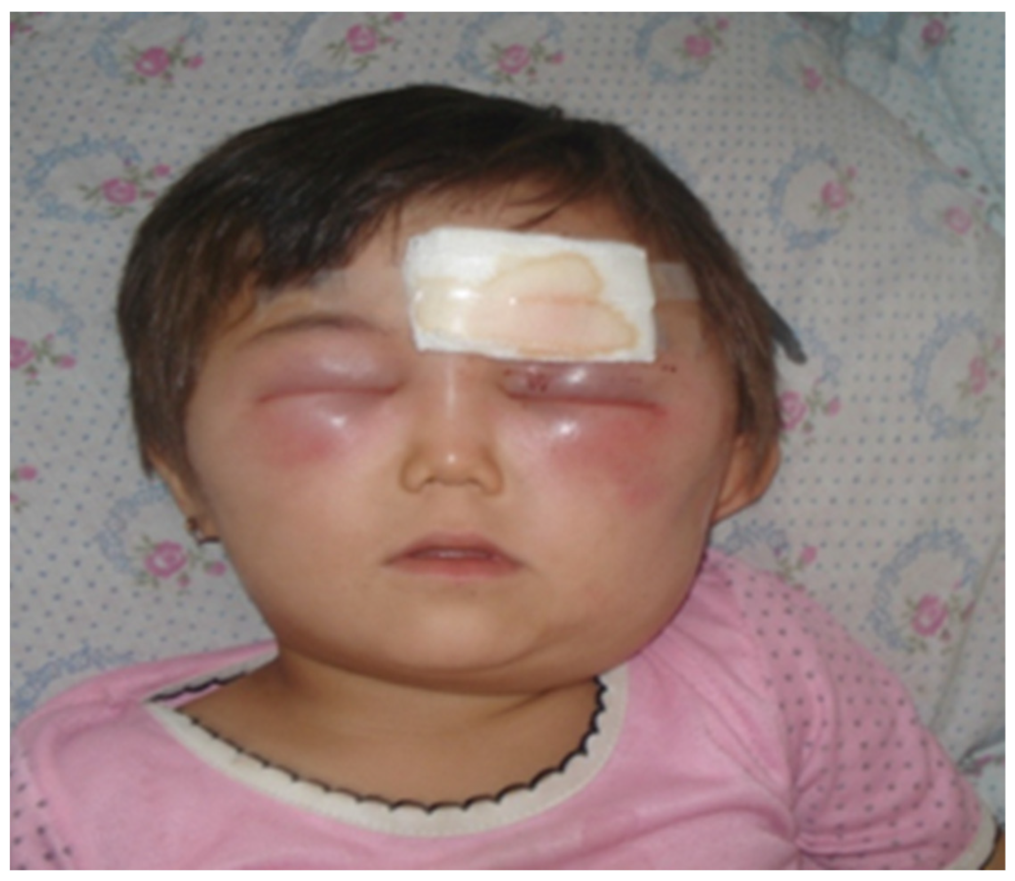 Diagnostics 13 01056 g004 Diagnostics 13 01056 g004