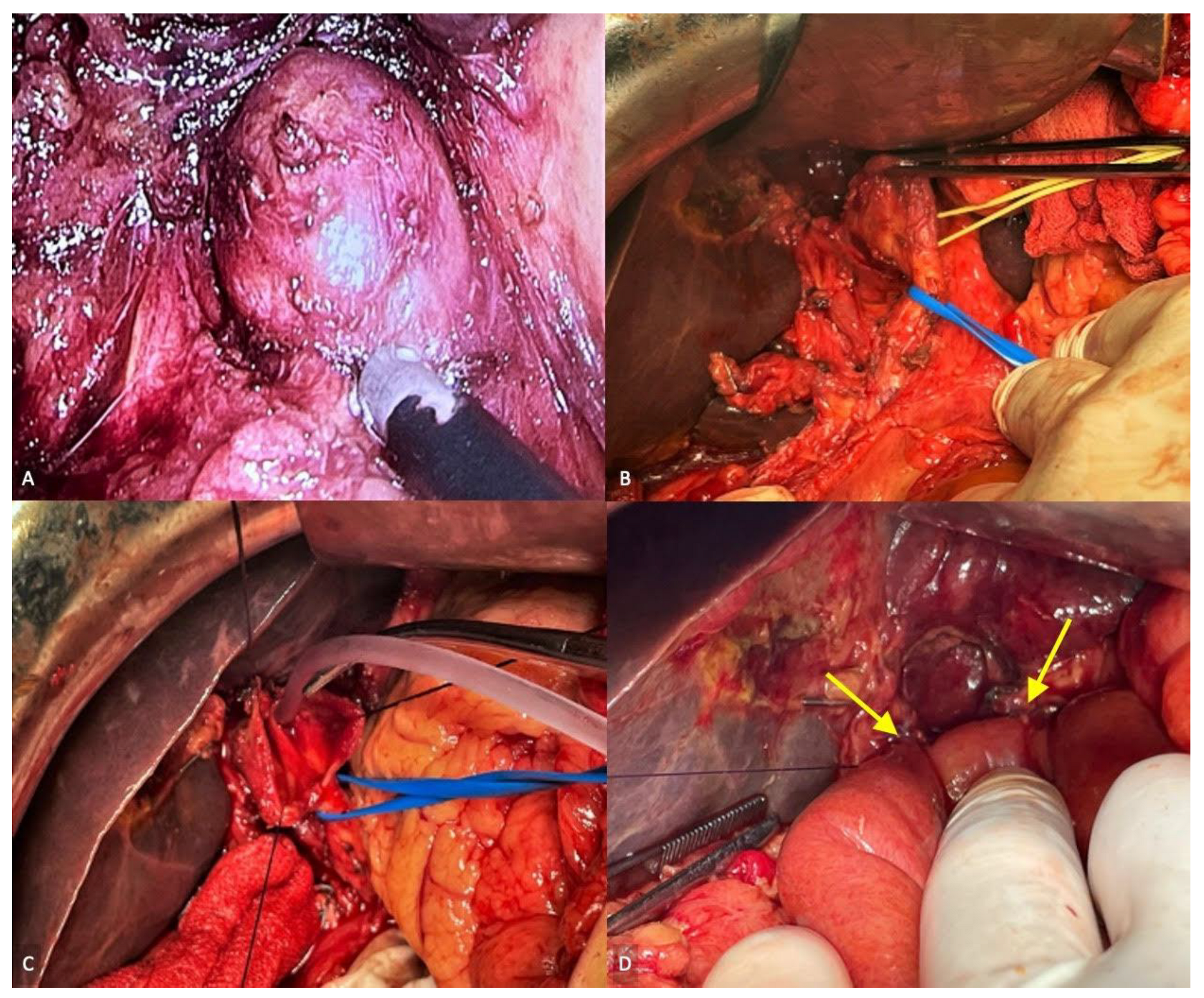 Diagnostics 13 01059 g003