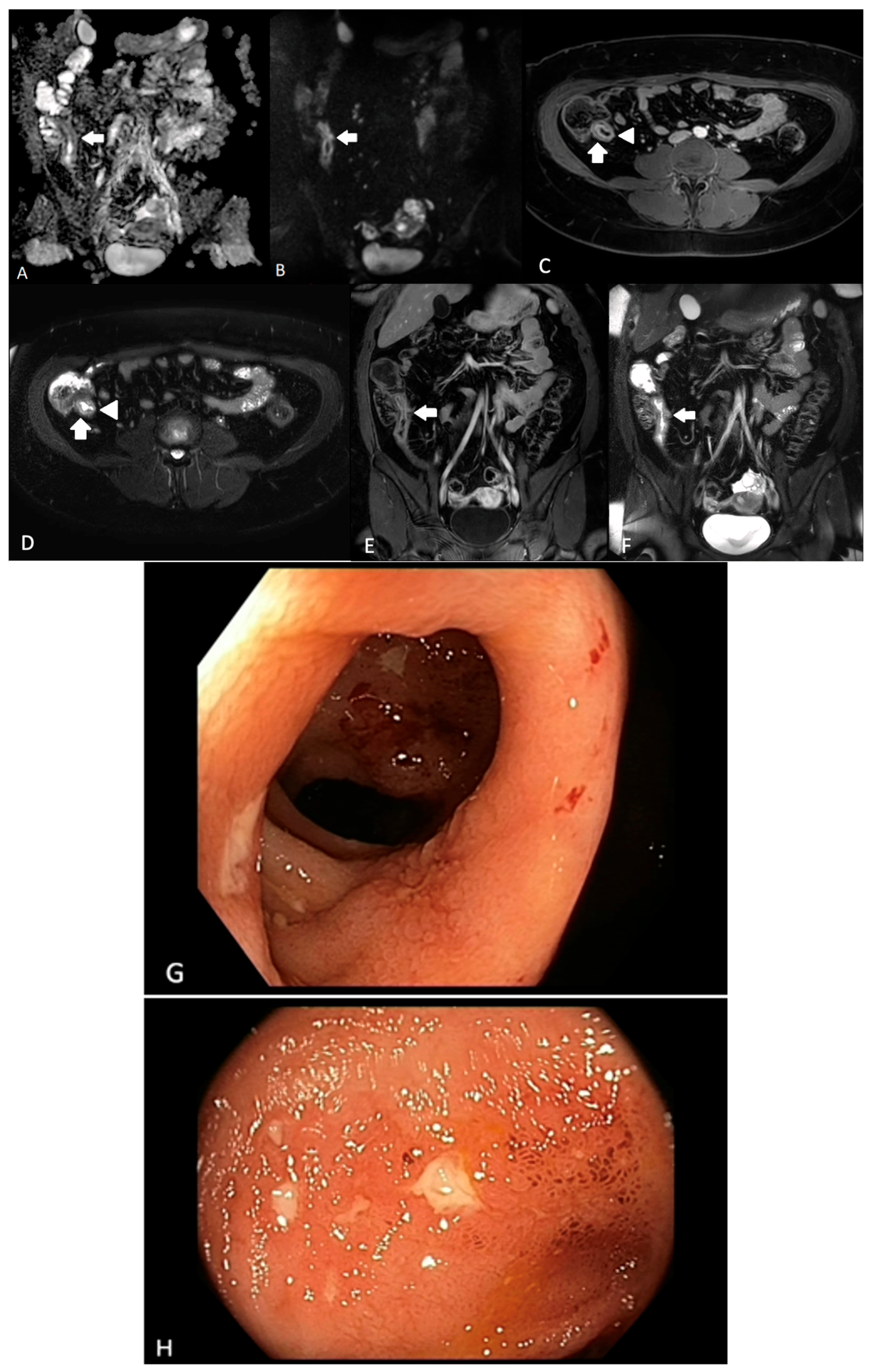 Diagnostics 13 01061 g001