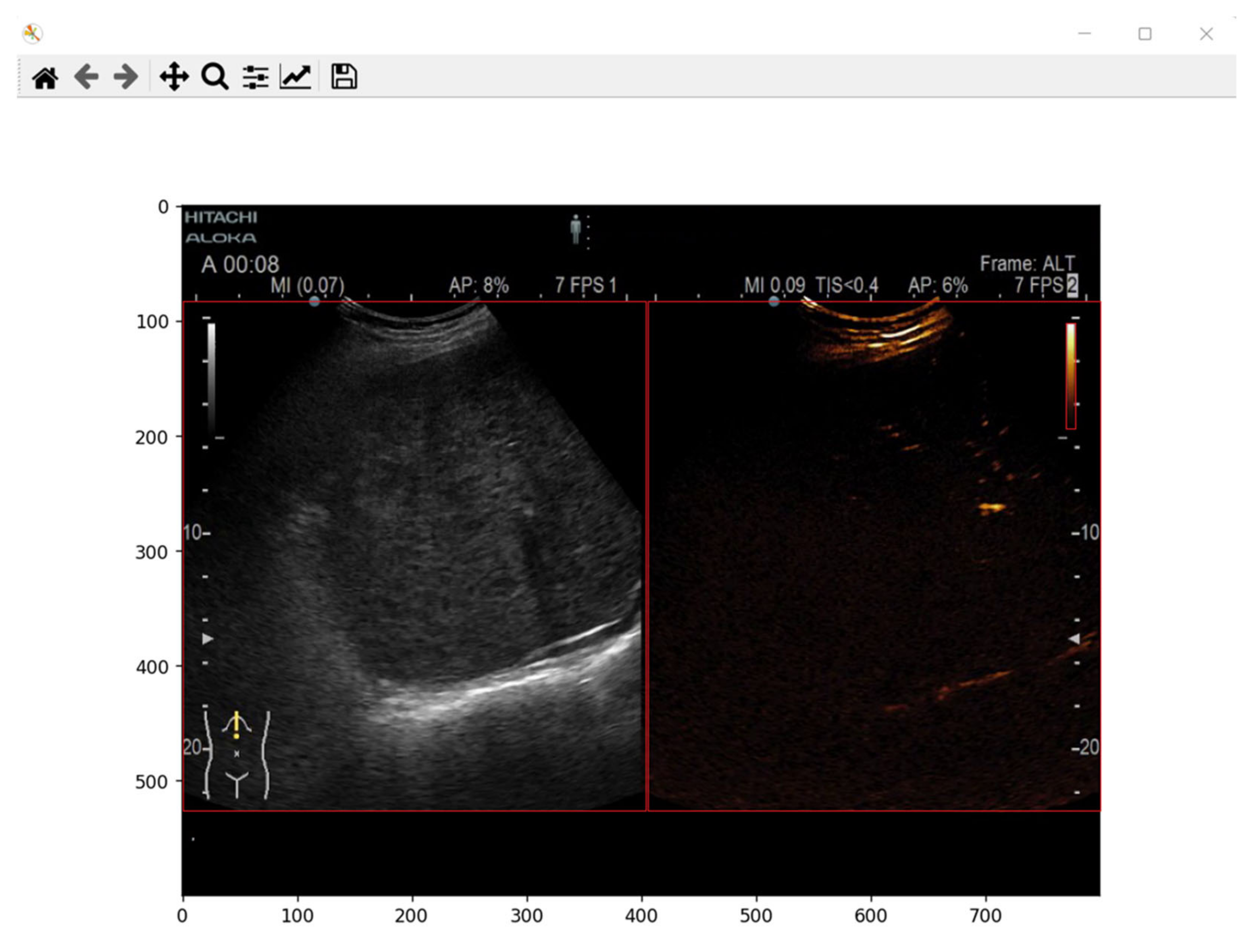 Diagnostics 13 01062 g003