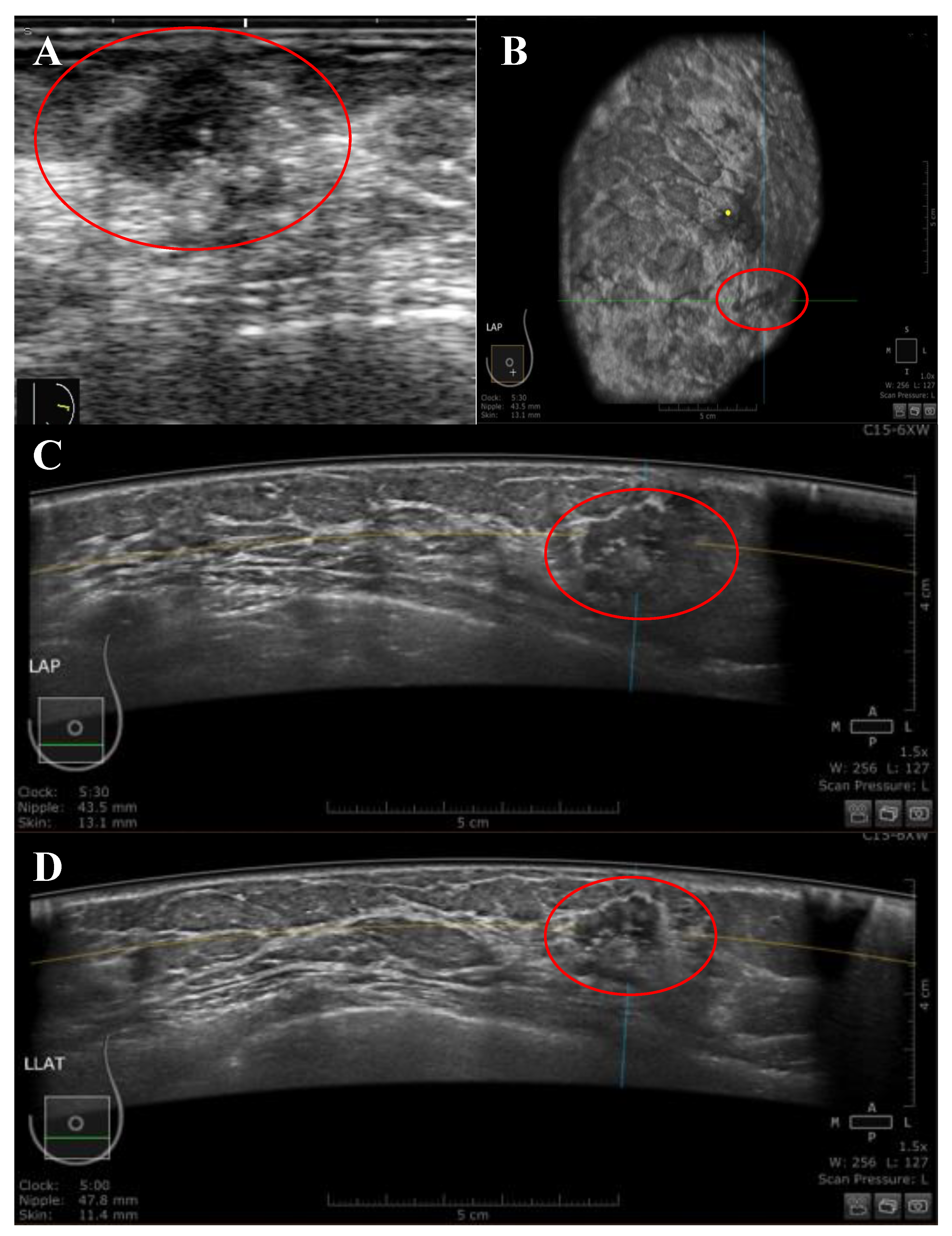 Diagnostics 13 01065 g002 Diagnostics 13 01065 g002