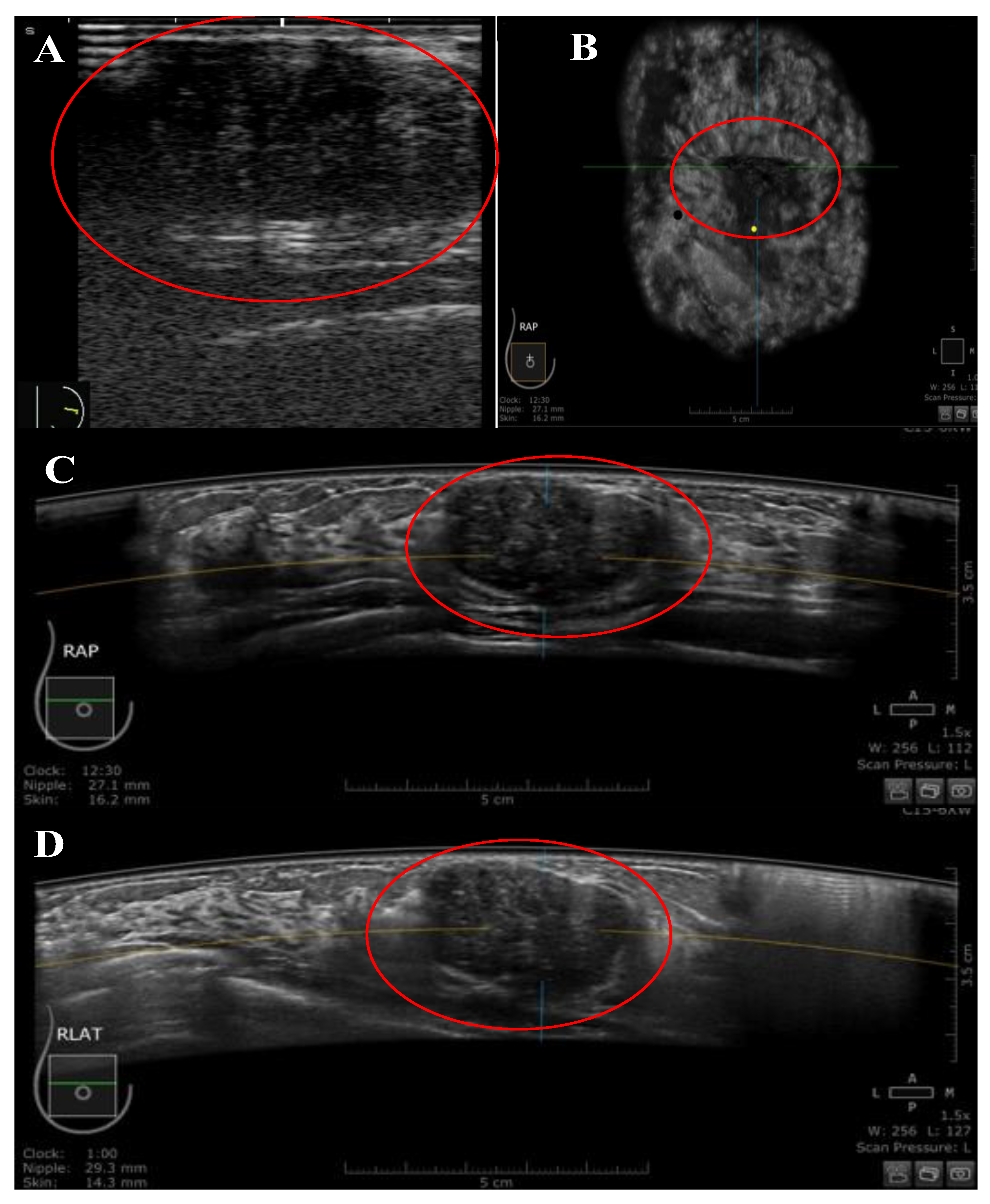 Diagnostics 13 01065 g003 Diagnostics 13 01065 g003