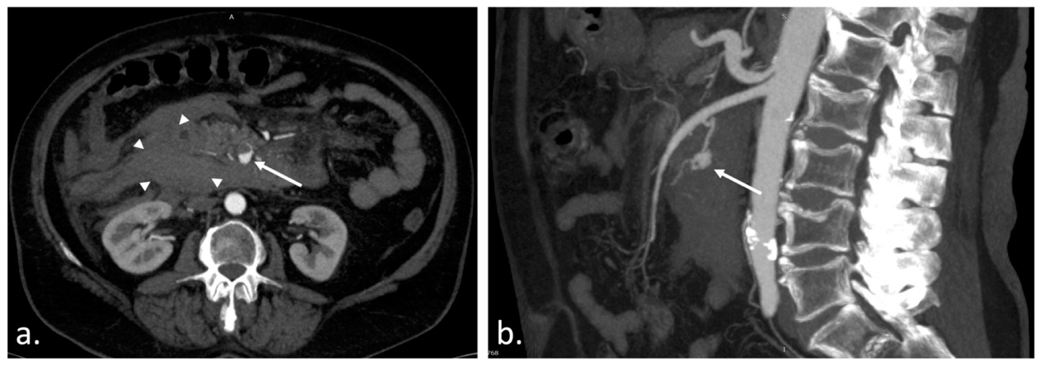 Diagnostics 13 01090 g001 Diagnostics 13 01090 g001