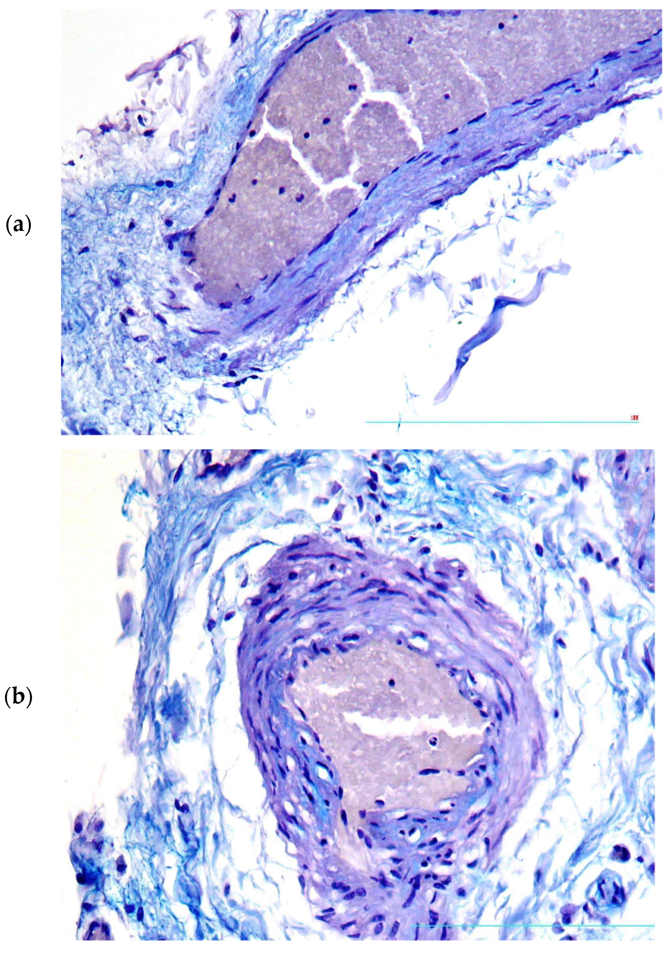 Diagnostics 13 01097 g002 Diagnostics 13 01097 g002
