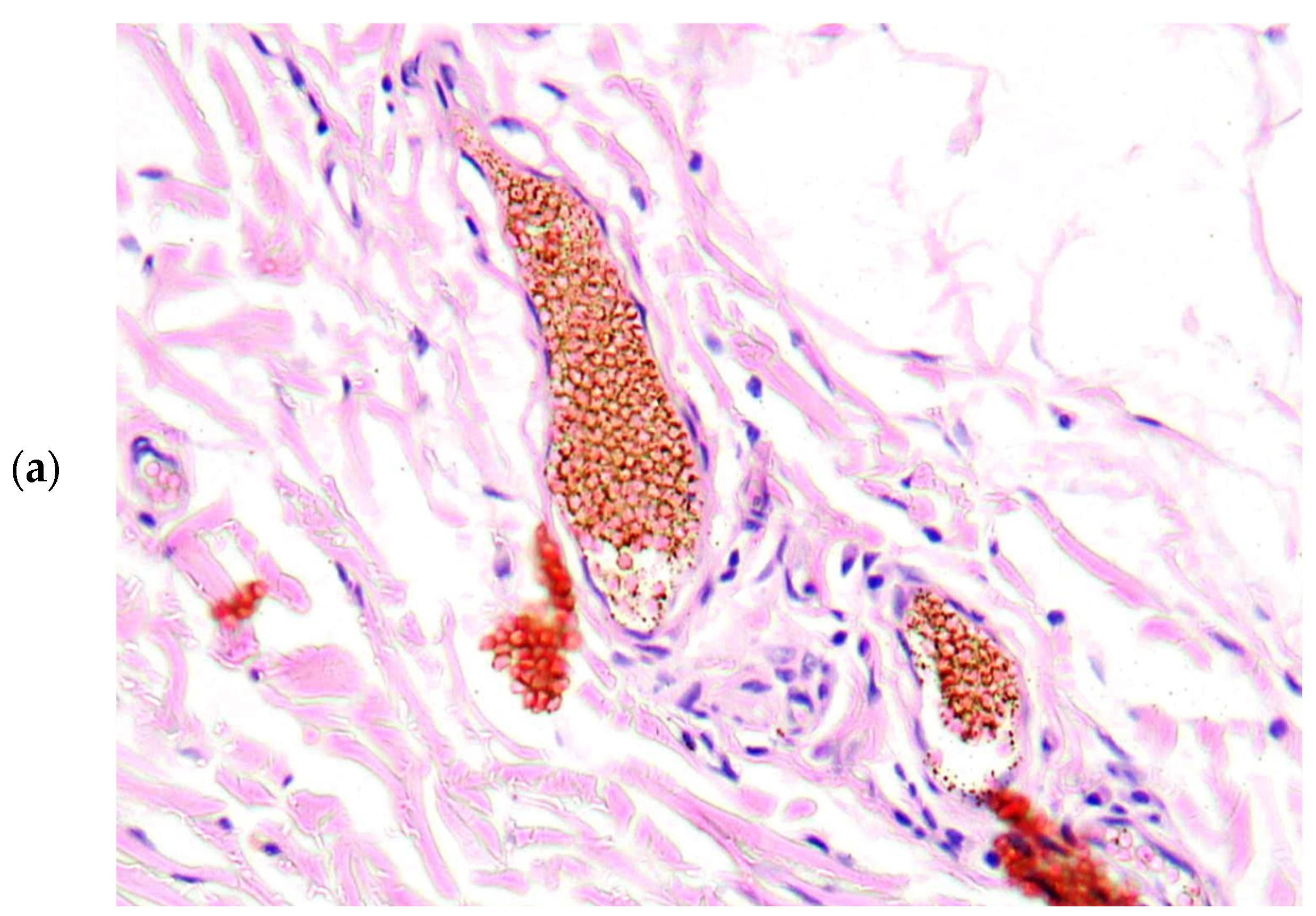 Diagnostics 13 01097 g004a Diagnostics 13 01097 g004a