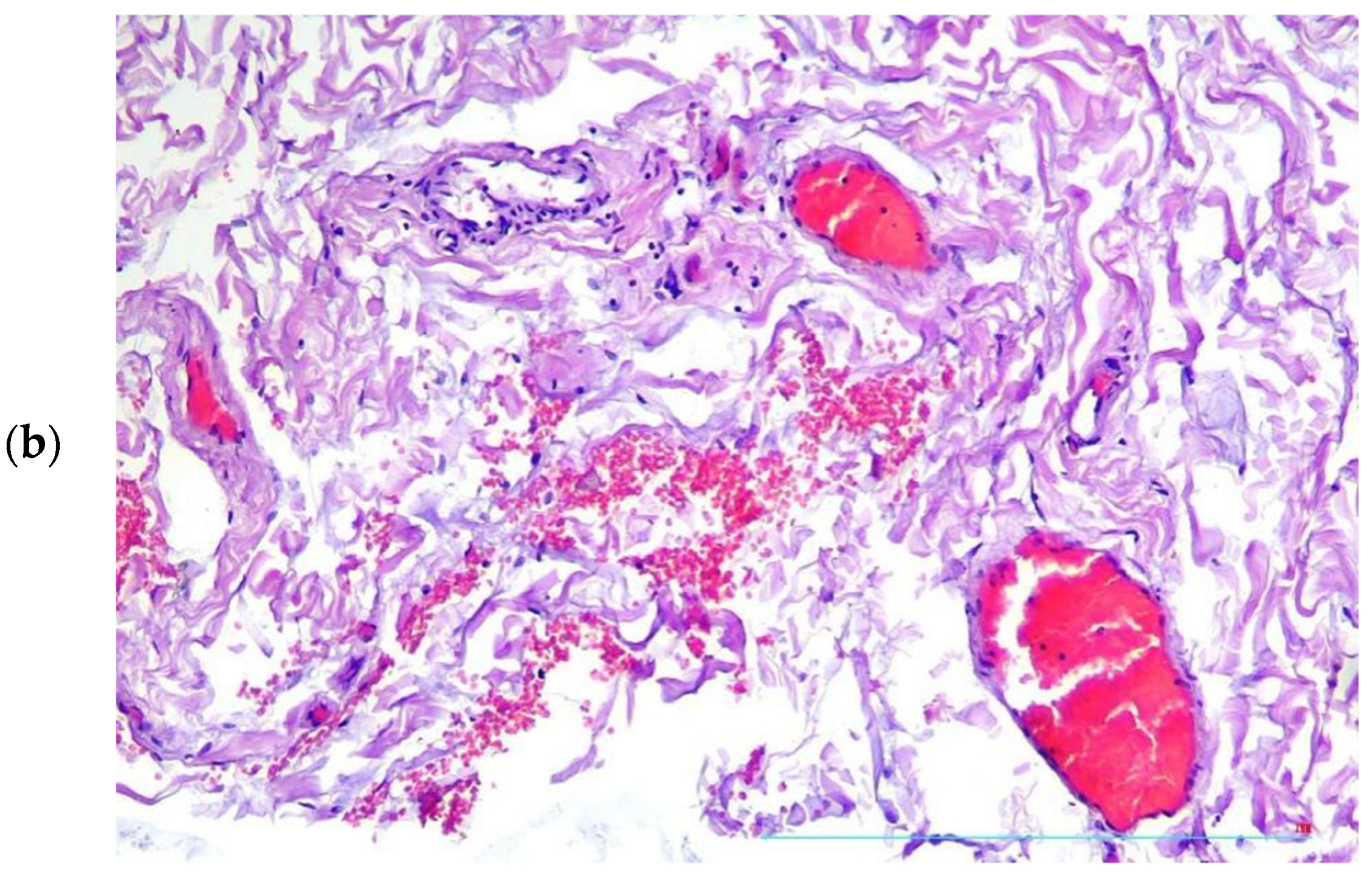 Diagnostics 13 01097 g004b Diagnostics 13 01097 g004b