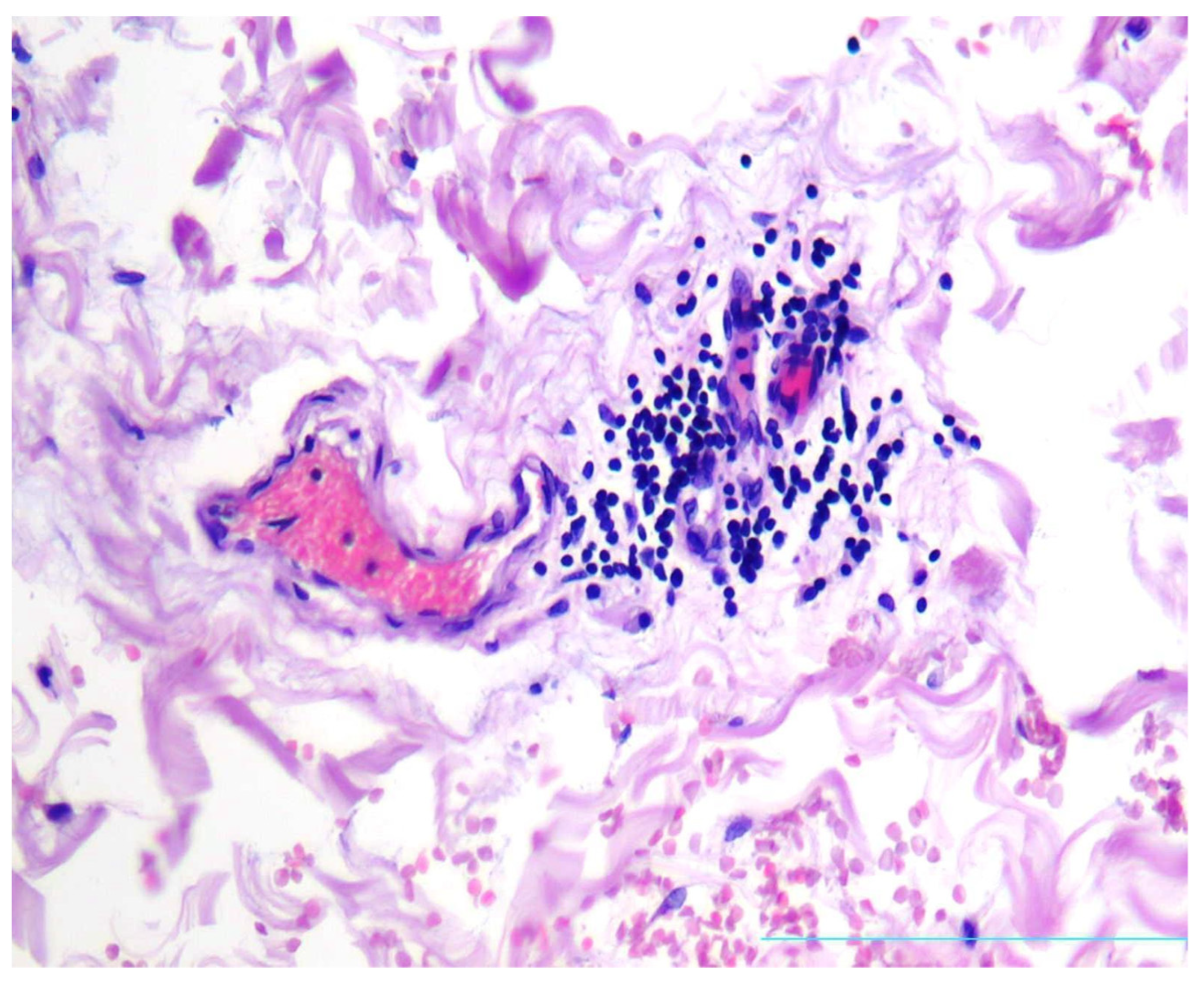 Diagnostics 13 01097 g005 Diagnostics 13 01097 g005