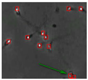 Diagnostics 13 01100 i012 Diagnostics 13 01100 i012