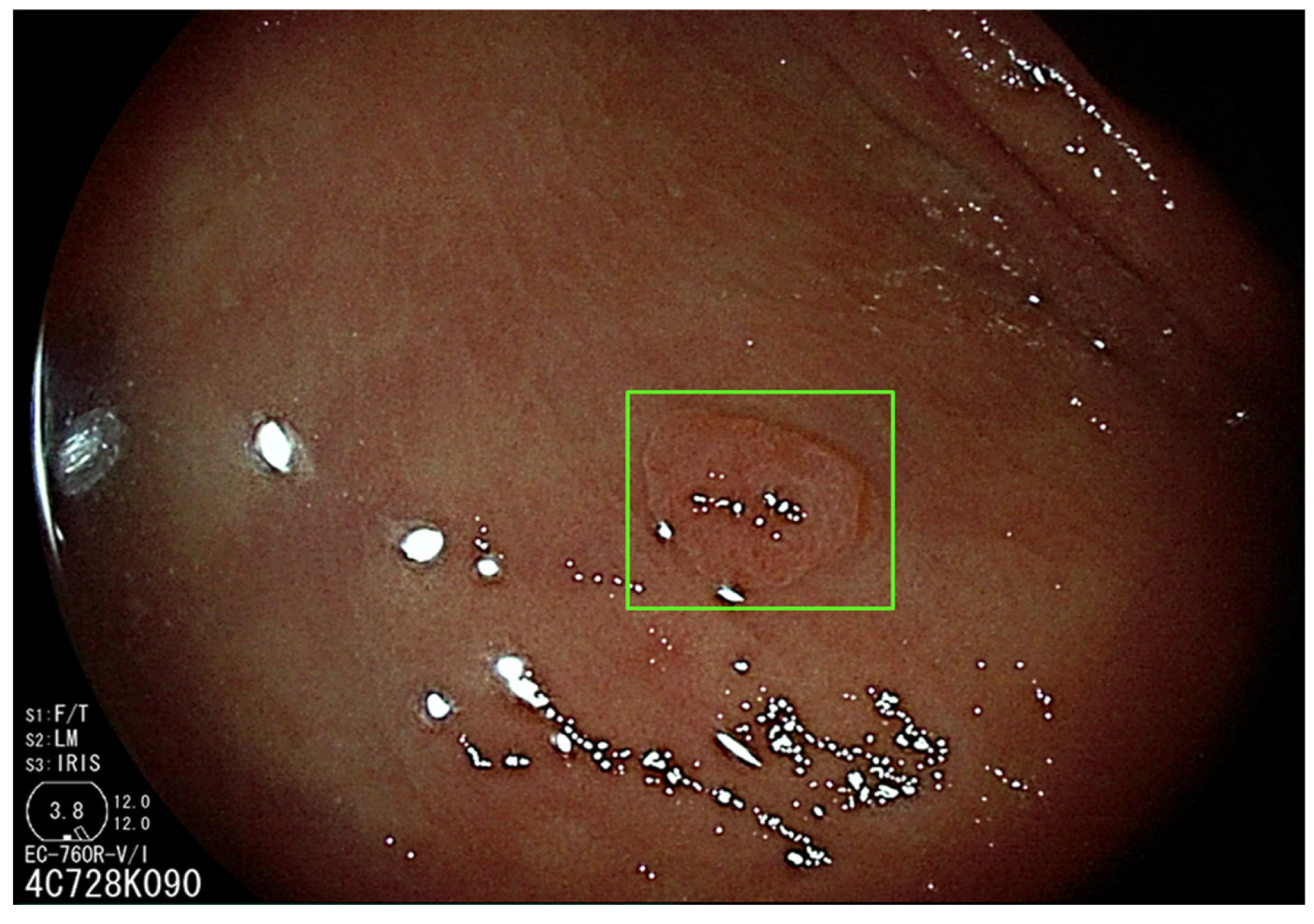 Diagnostics 13 01102 g002 Diagnostics 13 01102 g002