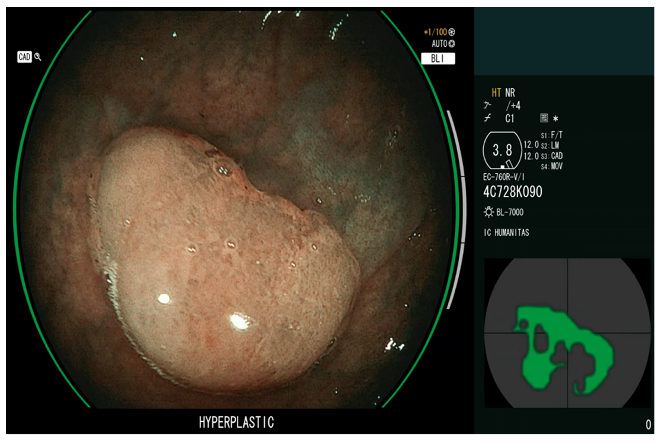 Diagnostics 13 01102 g003 Diagnostics 13 01102 g003