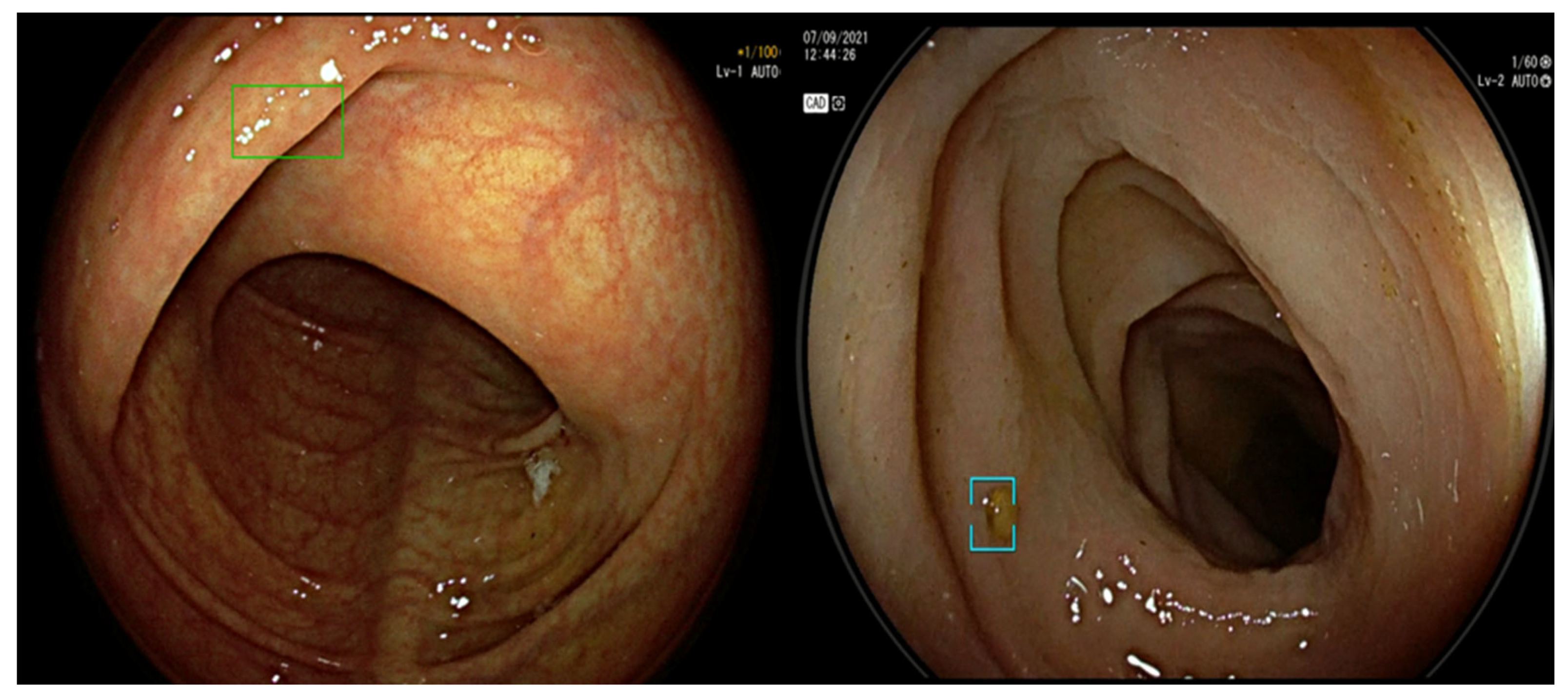 Diagnostics 13 01102 g004 Diagnostics 13 01102 g004