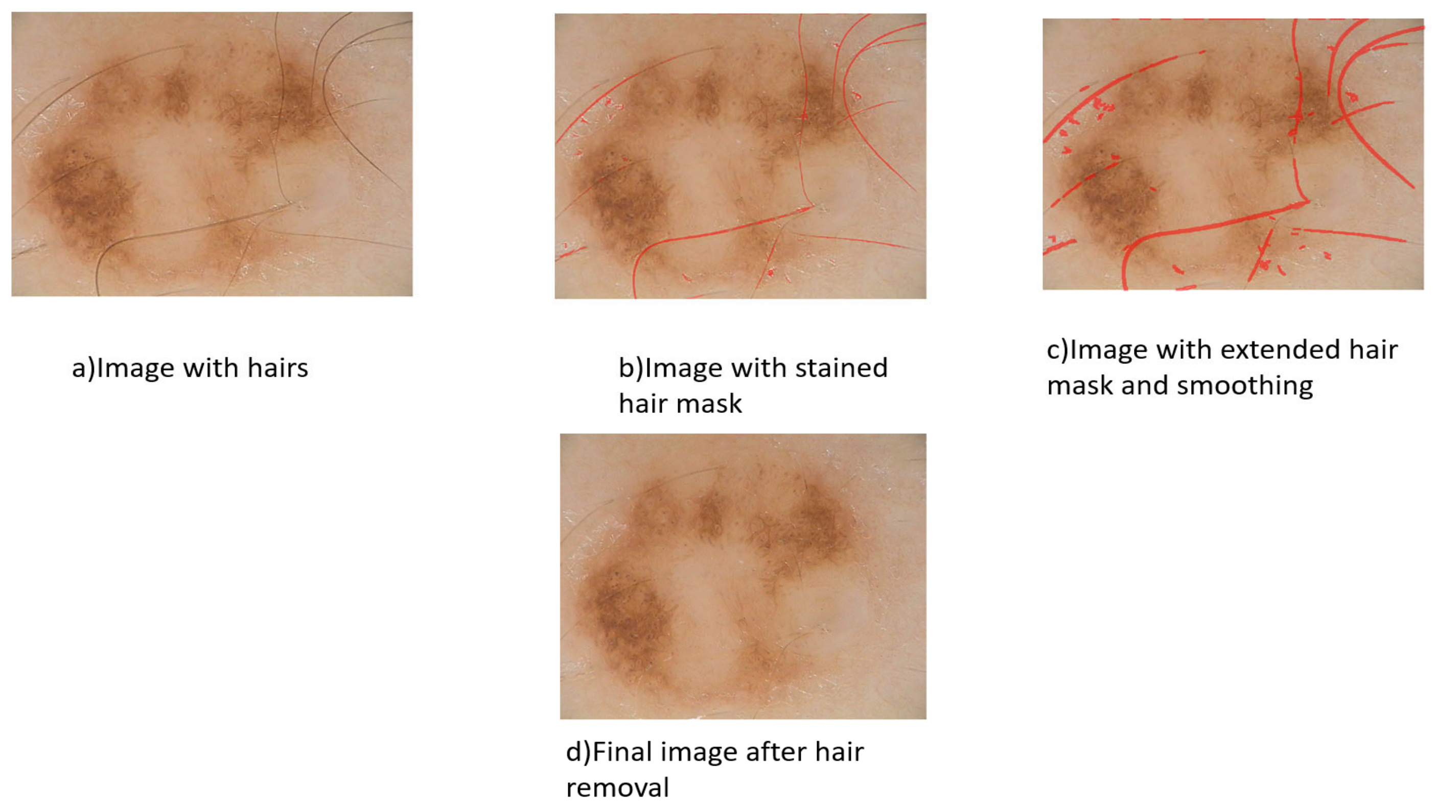 Diagnostics 13 01104 g003 Diagnostics 13 01104 g003