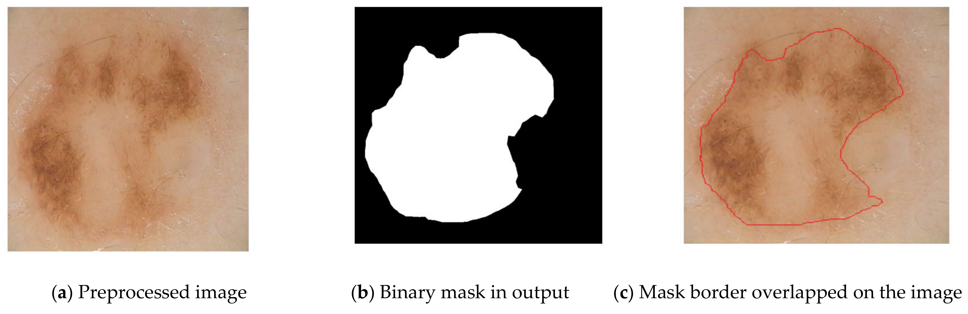 Diagnostics 13 01104 g004 Diagnostics 13 01104 g004