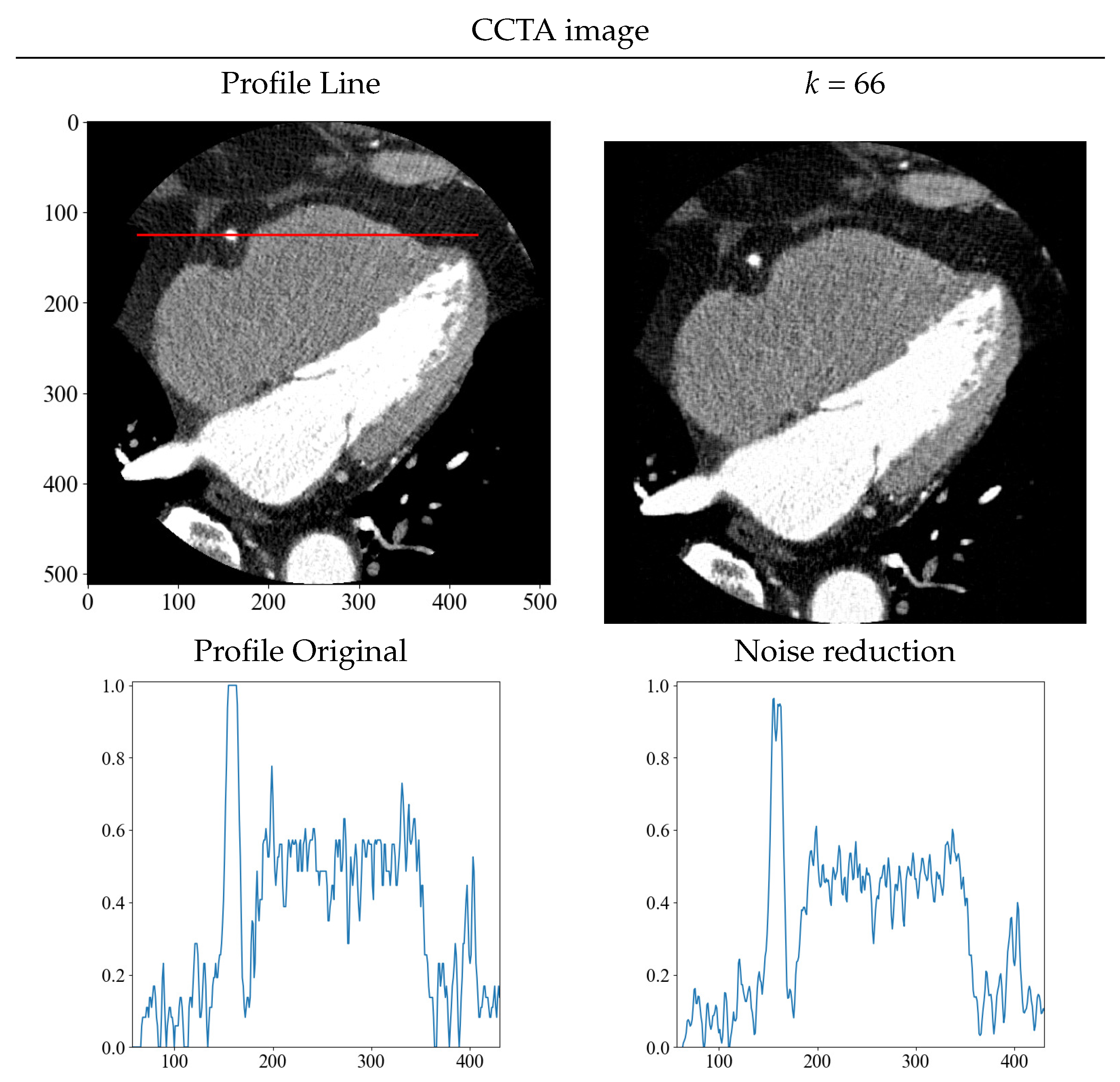 Diagnostics 13 01111 g012 Diagnostics 13 01111 g012