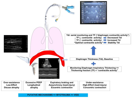 Diaphragm Contraction diaphragm-contraction