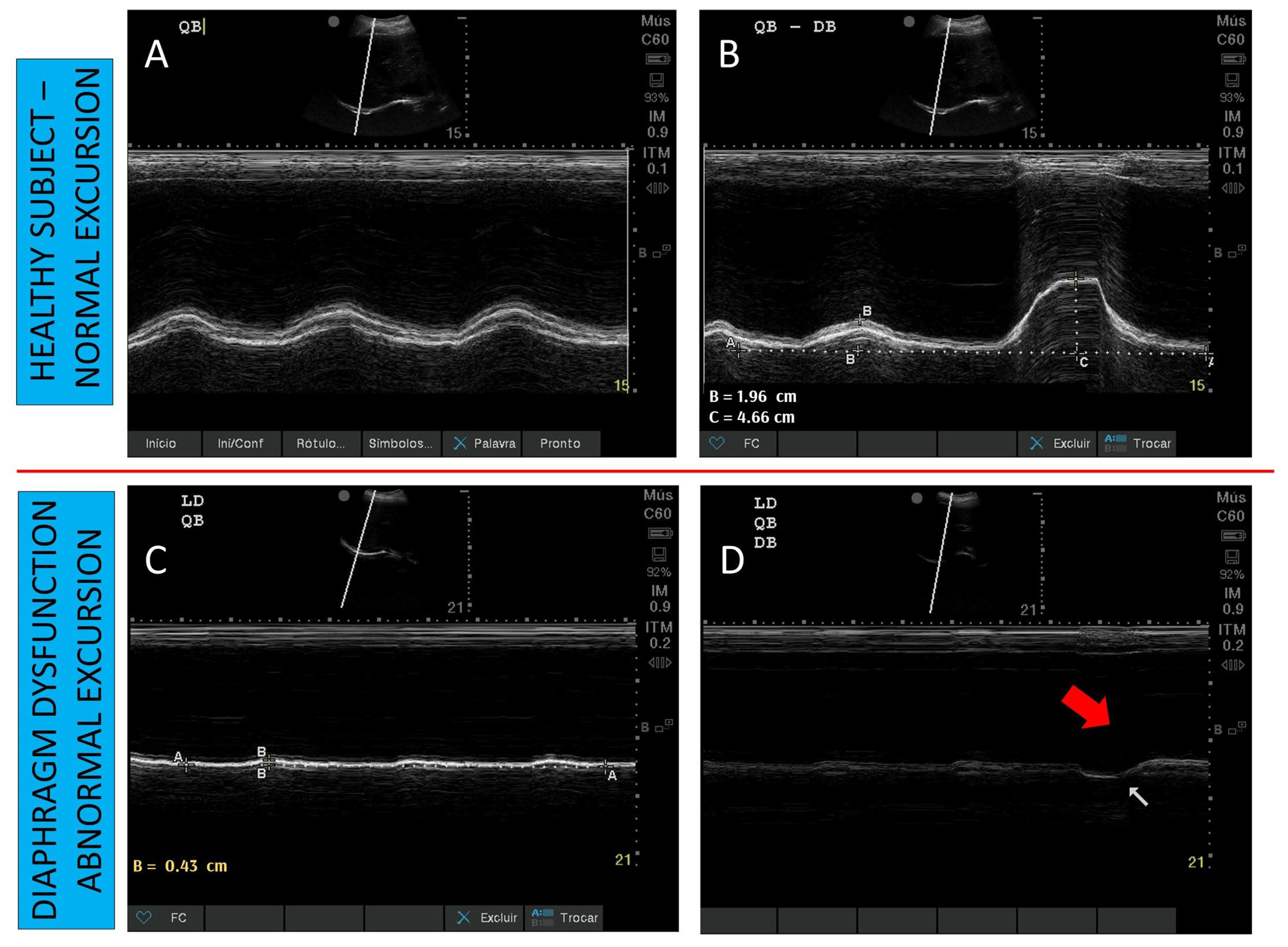 Diagnostics 13 01116 g003 Diagnostics 13 01116 g003
