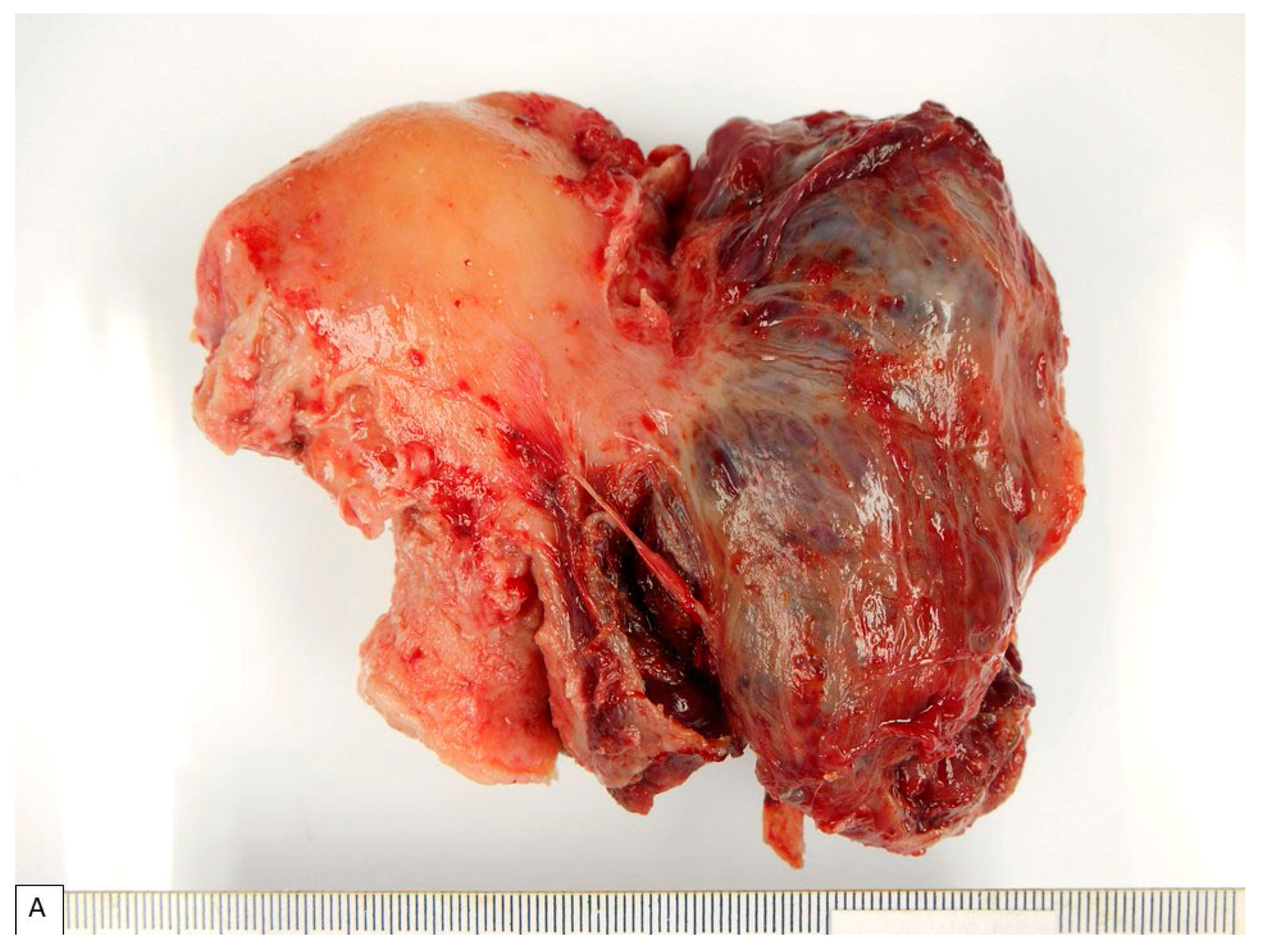 Diagnostics 13 01119 g001a Diagnostics 13 01119 g001a