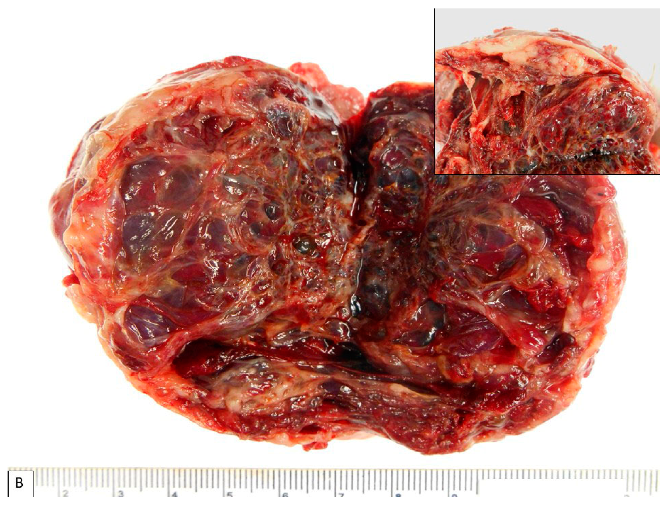 Diagnostics 13 01119 g001b Diagnostics 13 01119 g001b