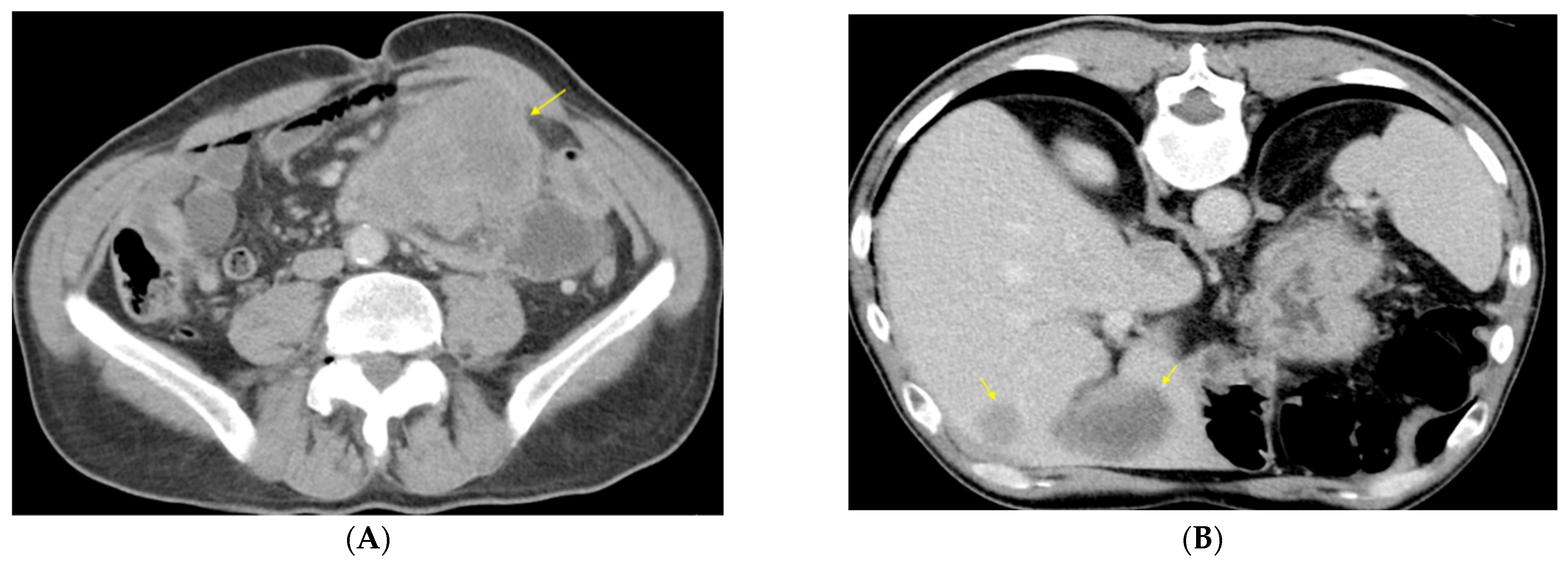 Diagnostics 13 01131 g001