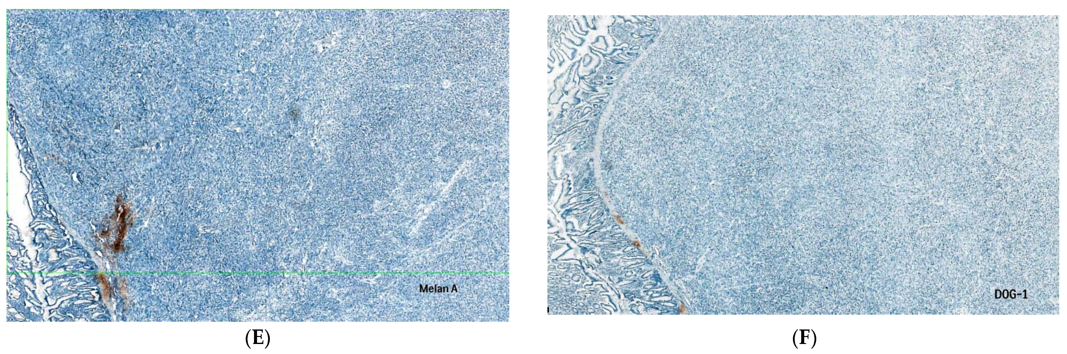 Diagnostics 13 01131 g003b