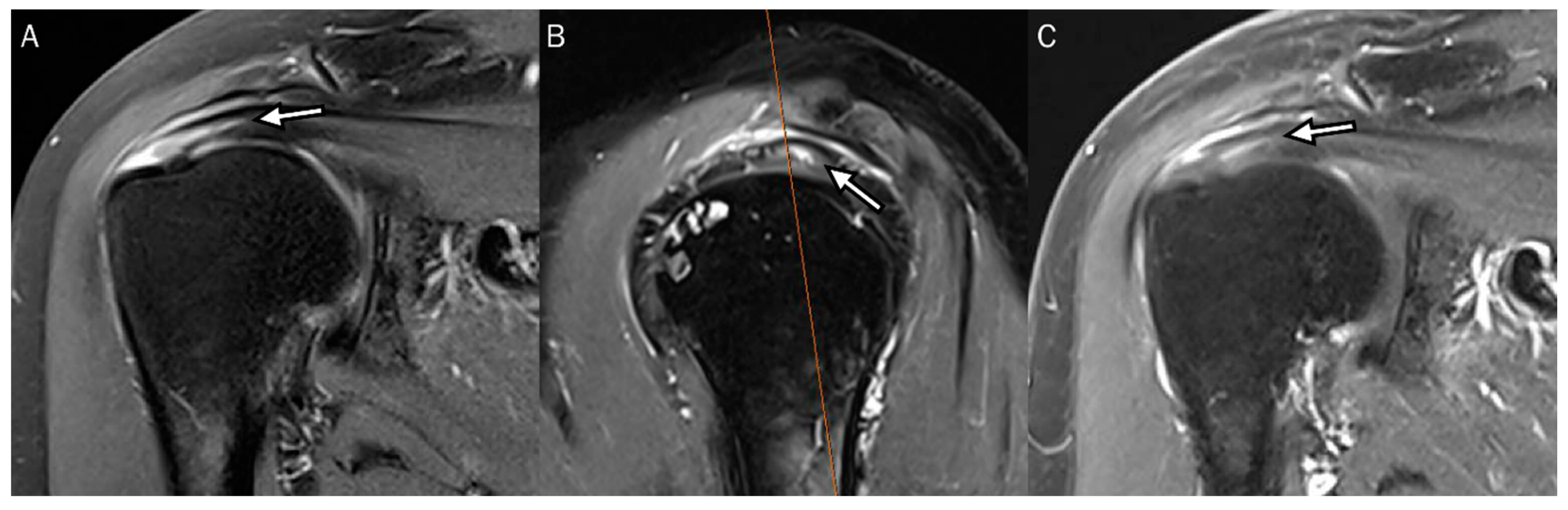 Diagnostics 13 01133 g004 Diagnostics 13 01133 g004