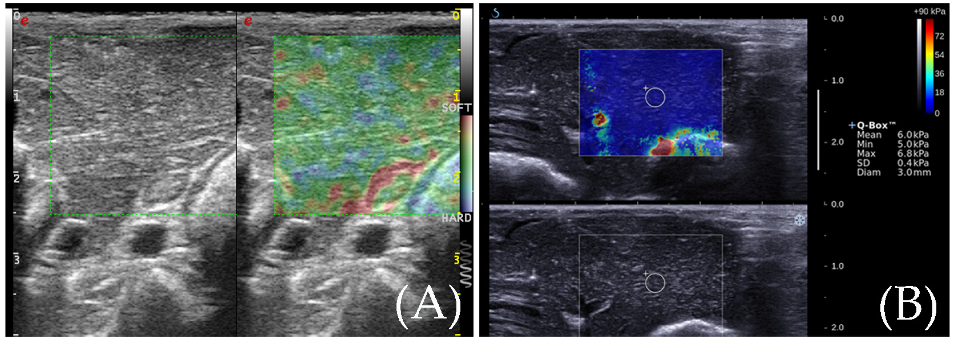Diagnostics 13 01145 g002
