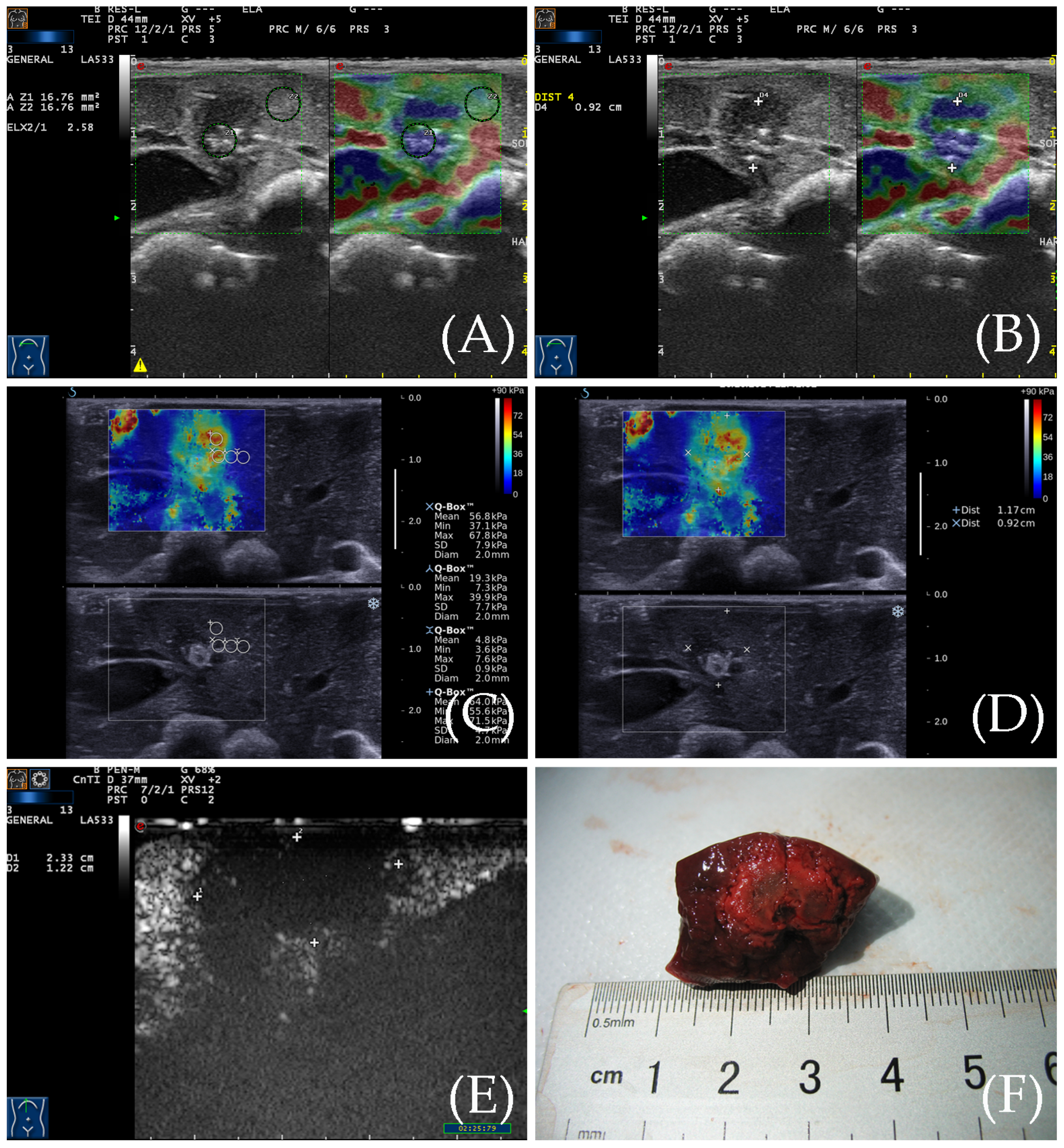 Diagnostics 13 01145 g003