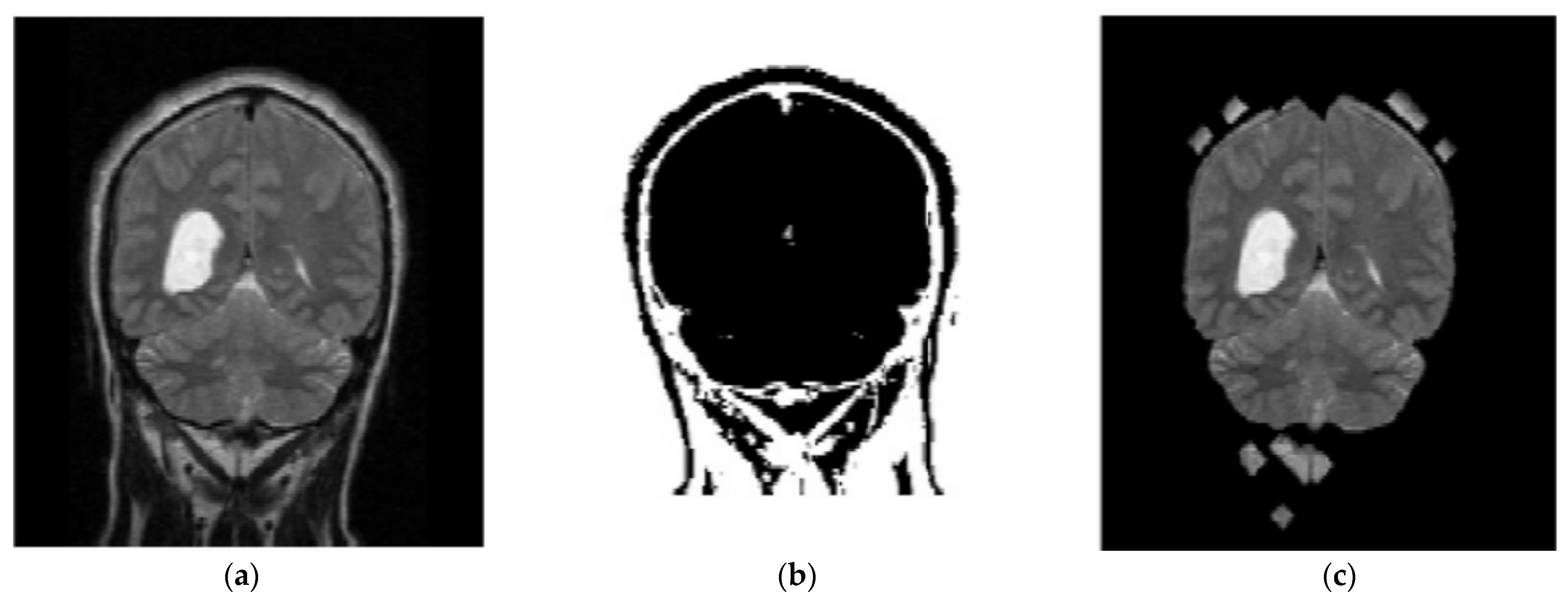 Diagnostics 13 01153 g004