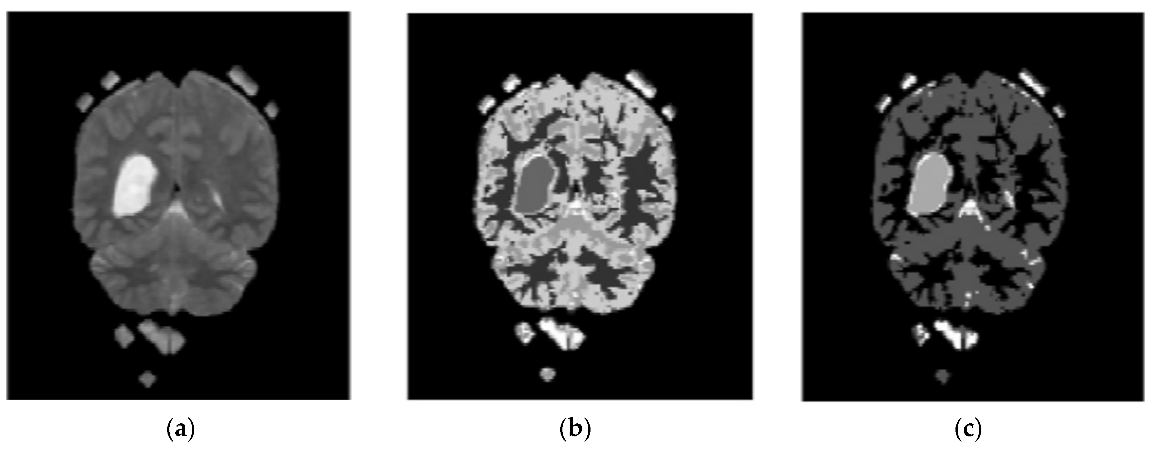 Diagnostics 13 01153 g005