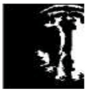 Diagnostics 13 01153 i002