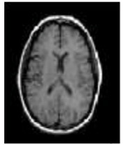 Diagnostics 13 01153 i003