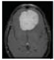 Diagnostics 13 01153 i004