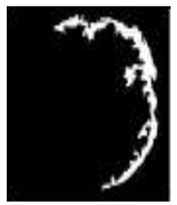 Diagnostics 13 01153 i005